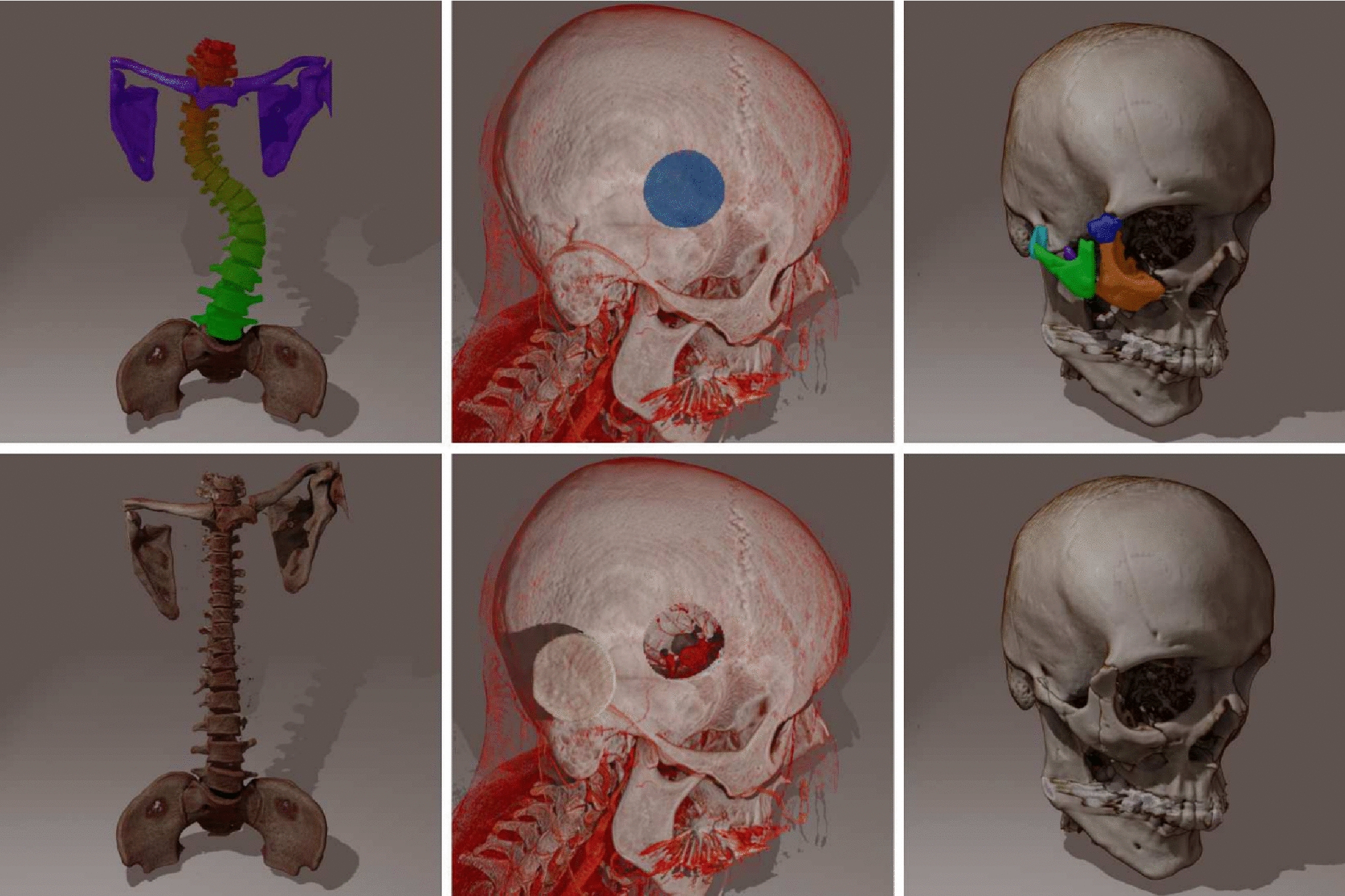 Multi-volume rendering using depth buffers for surgical planning in virtual reality