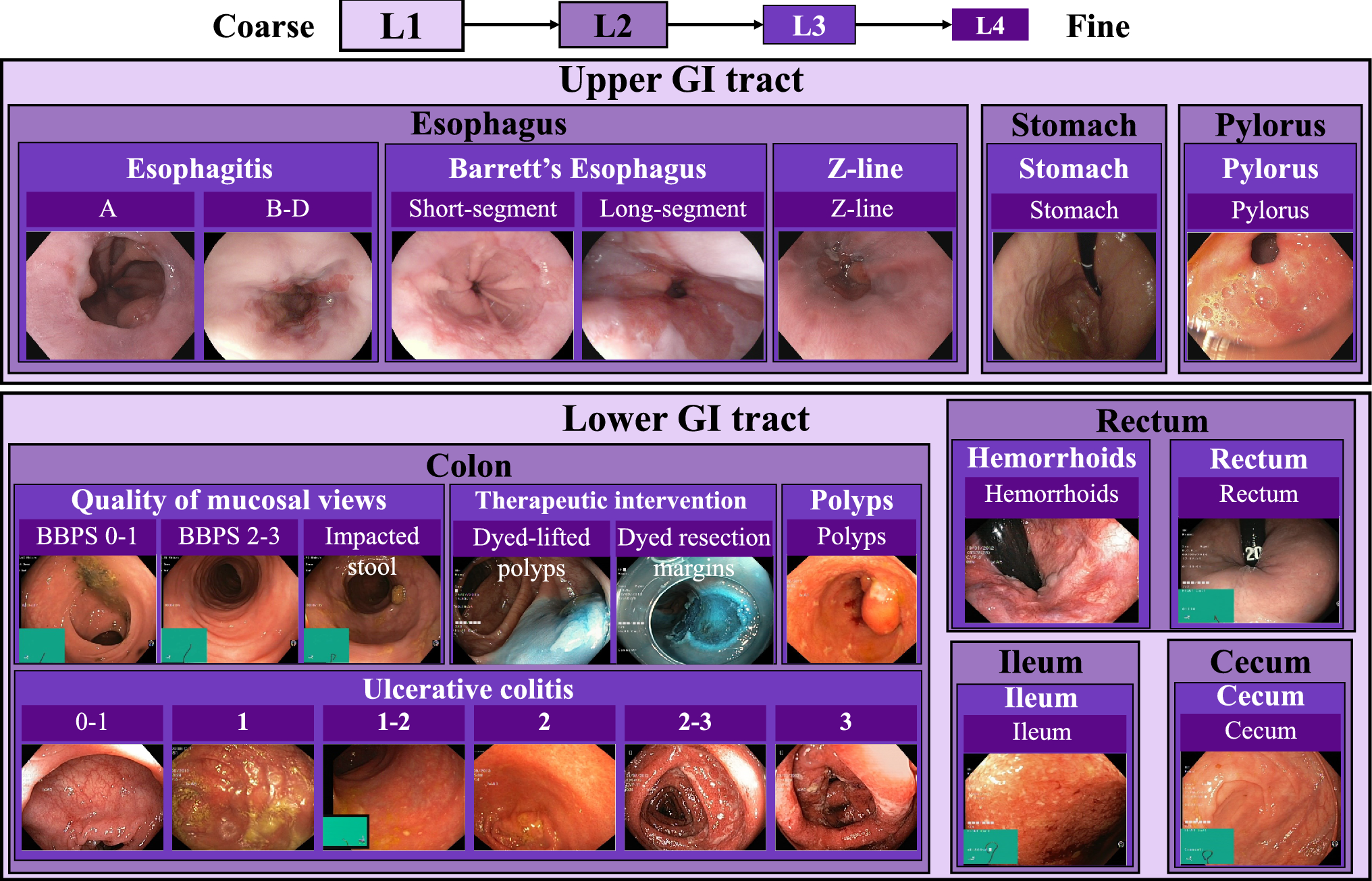 DivGI: delve into digestive endoscopy image classification