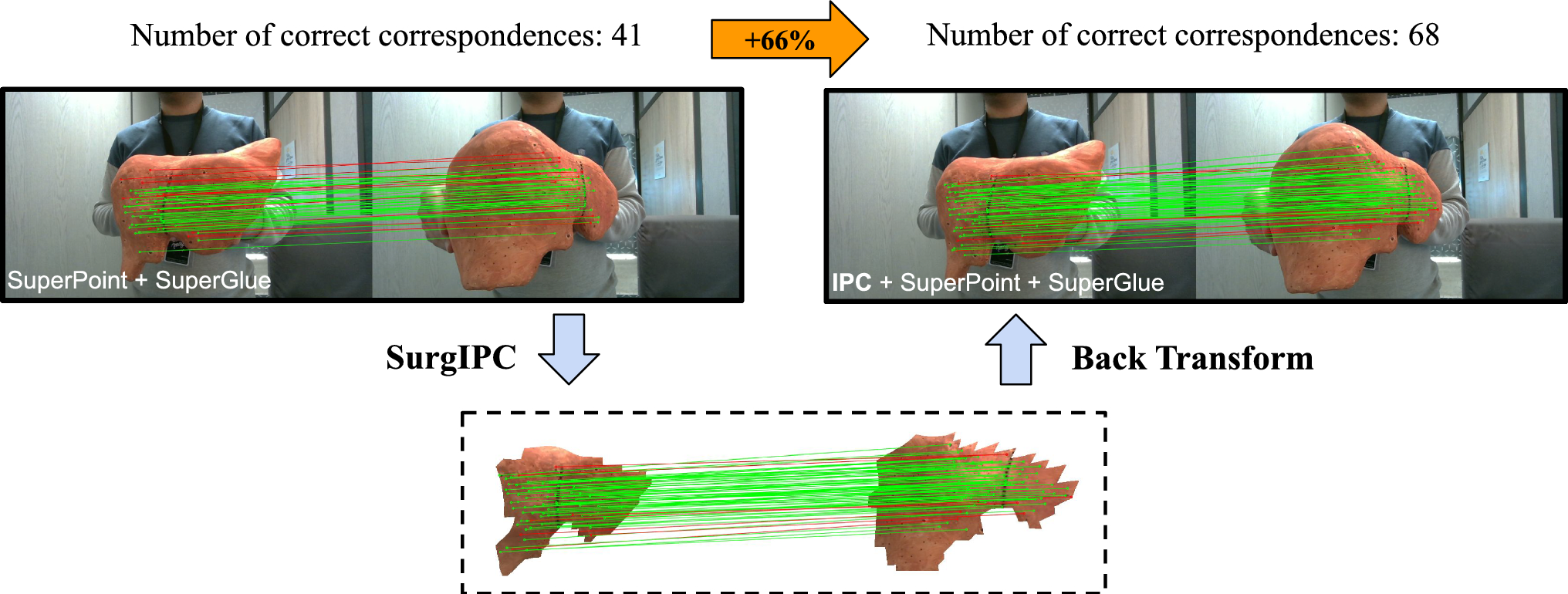SurgIPC: a convex image perspective correction method to boost surgical keypoint matching