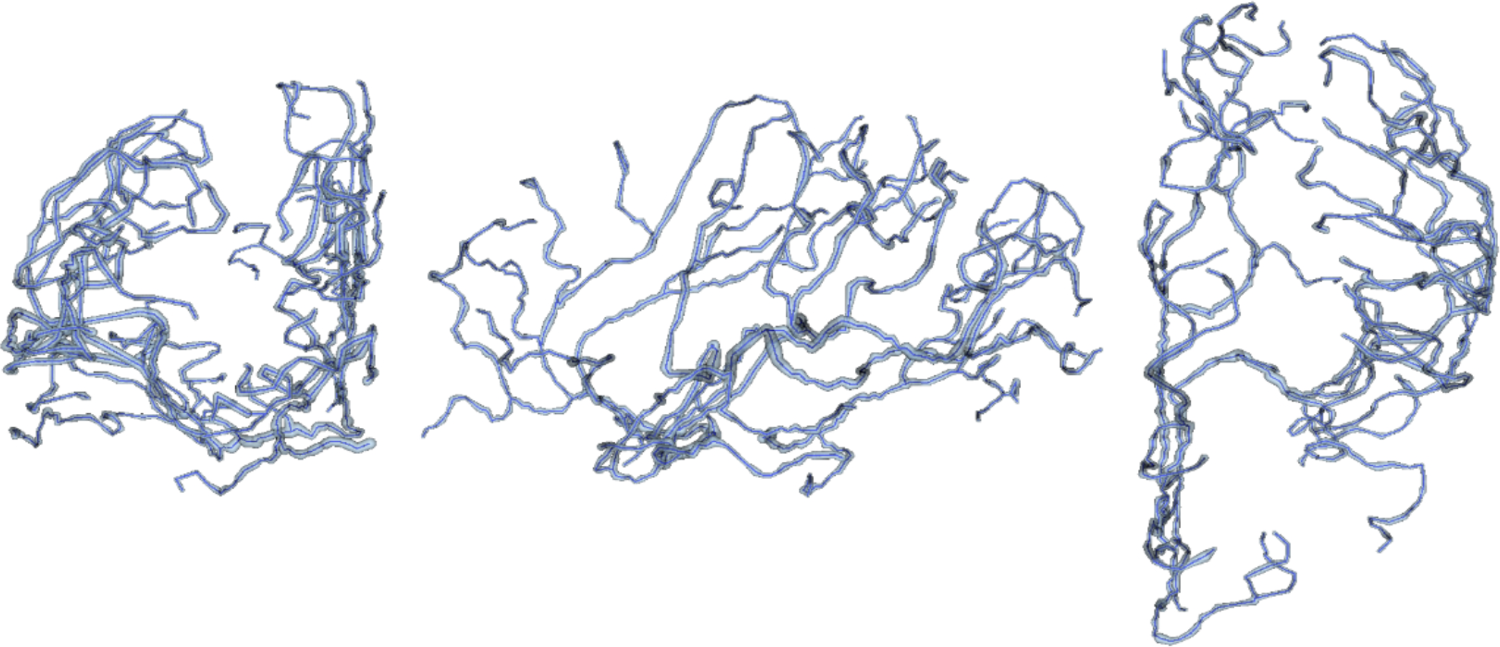 Spatiotemporally constrained 3D reconstruction from biplanar digital subtraction angiography