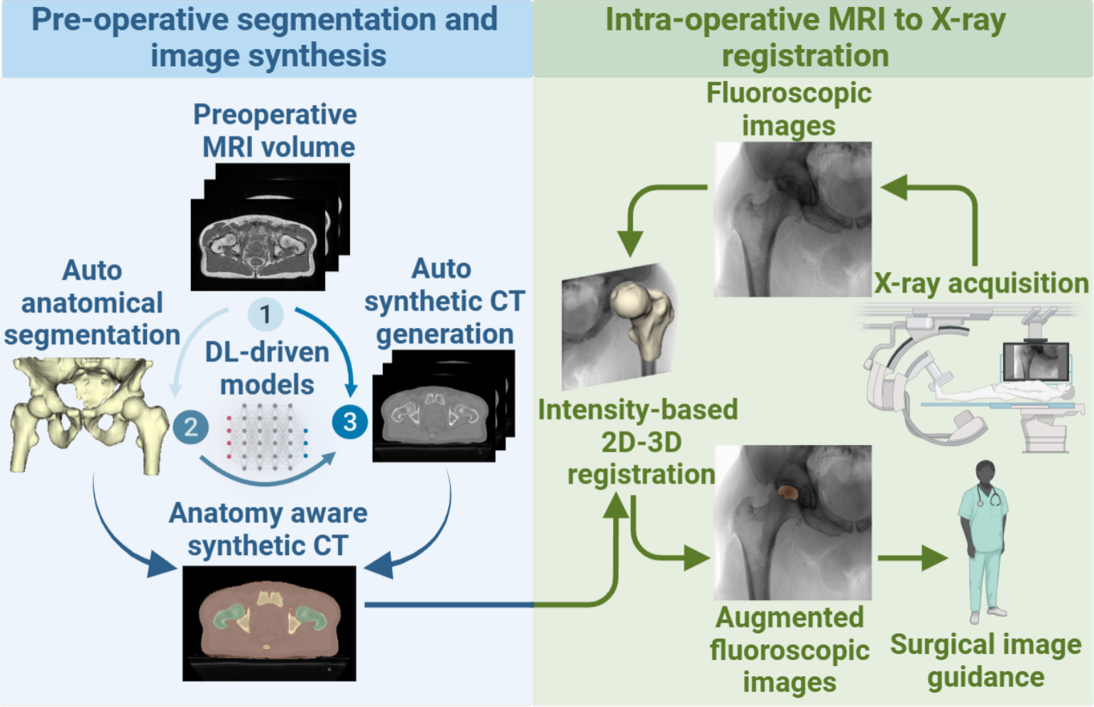 End-to-end 2D/3D registration from pre-operative MRI to intra-operative fluoroscopy for orthopedic procedures