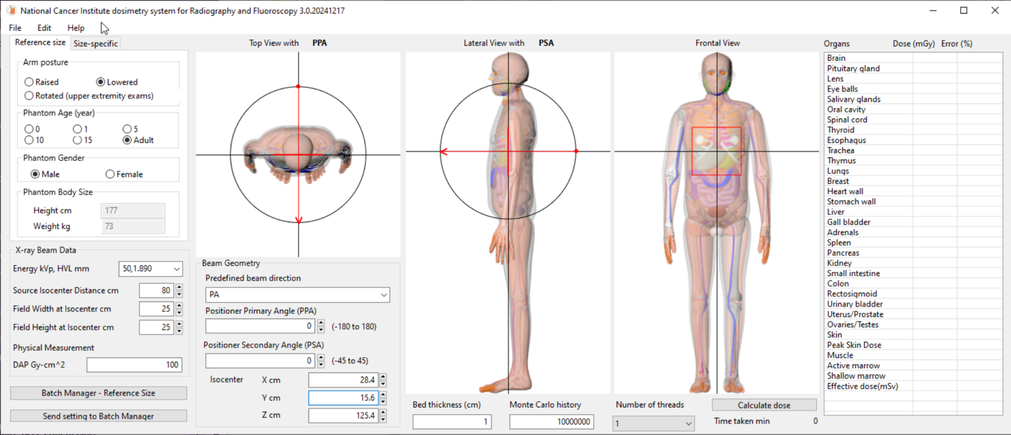 Training a deep learning model to predict the anatomy irradiated in fluoroscopic x-ray images