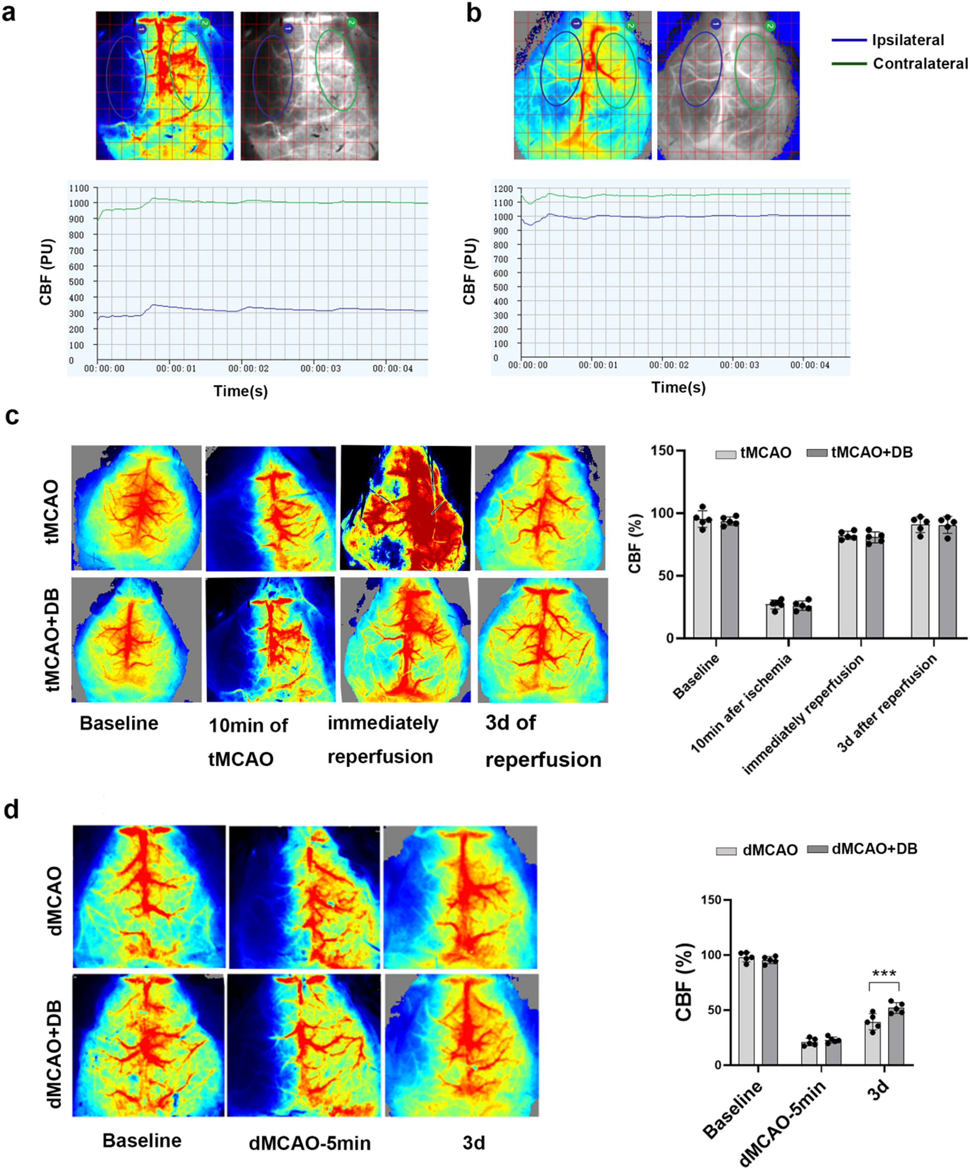 Dragon’s Blood Modulates Disulfidptosis-Related Genes to Alleviate Ischemic Brain Injury in Mice