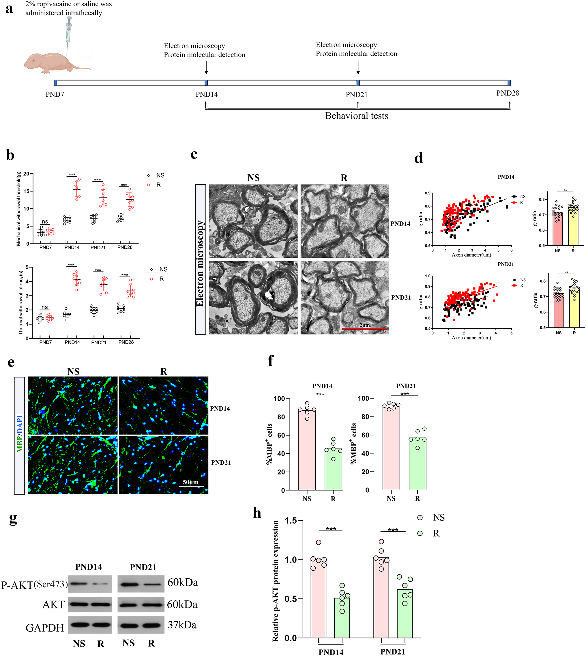 Ropivacaine Mediates Mitochondrial Dysfunction and Ca Oscillations Attenuation in OPCs Leading to Developmental Spinal Dysmyelination by Inhibiting Akt Signaling