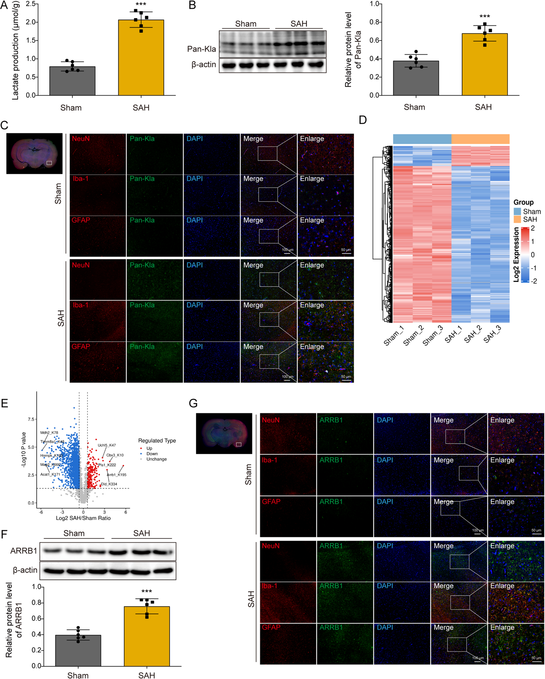 P300-Mediated ARRB1 Lactylation Promotes Mitochondrial Dysfunction and Neuronal Apoptosis in Subarachnoid Hemorrhage Via Upregulating S100A9