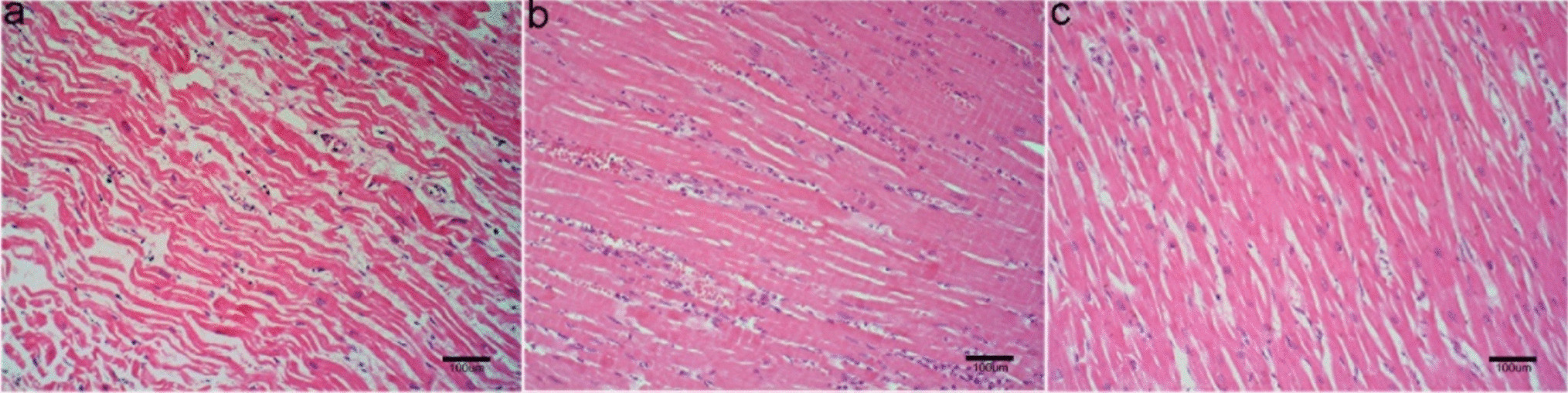 A preliminary study on cause‑of‑death discrimination and the pathological stage identification in acute ischemia heart disease (AIHD) based on plasma lipidomic technique and machine learning algorithms