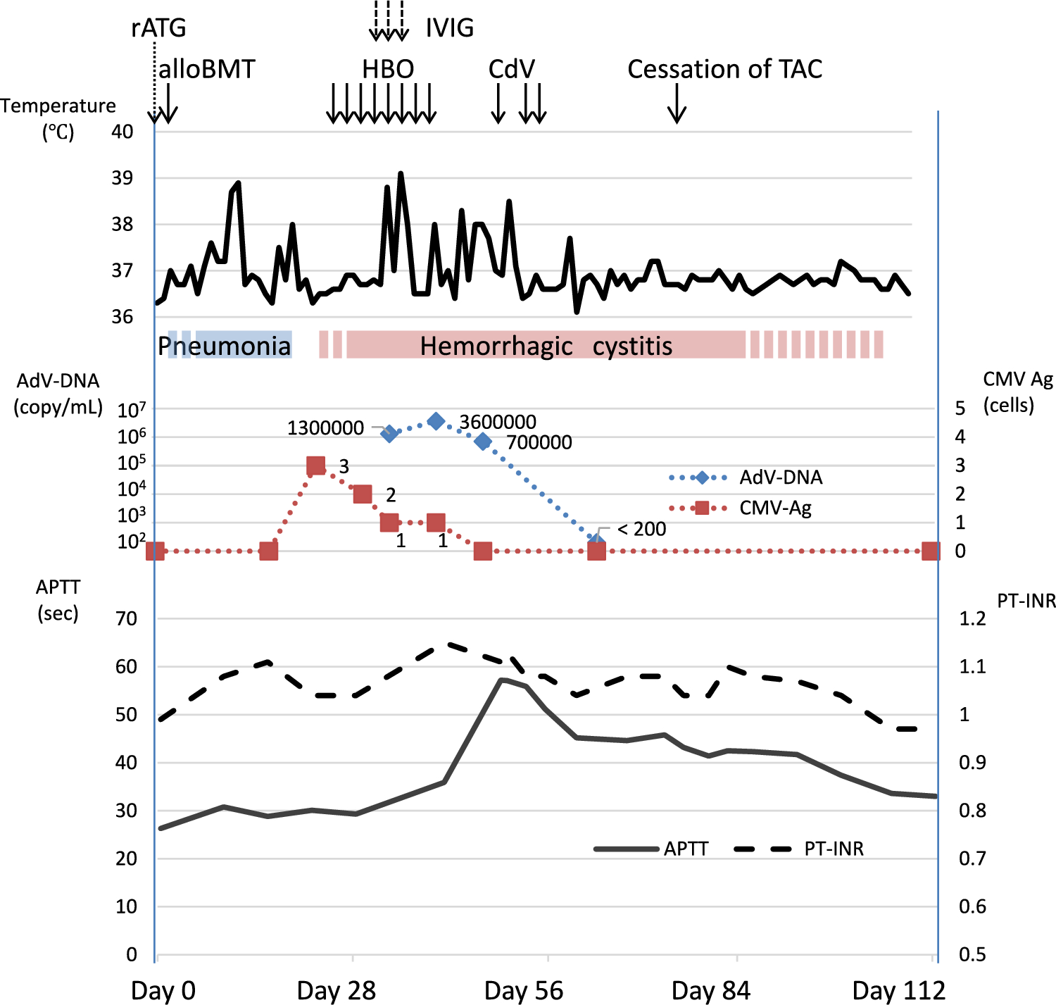 Transient lupus anticoagulant induced by adenovirus cystitis in a bone marrow transplant recipient