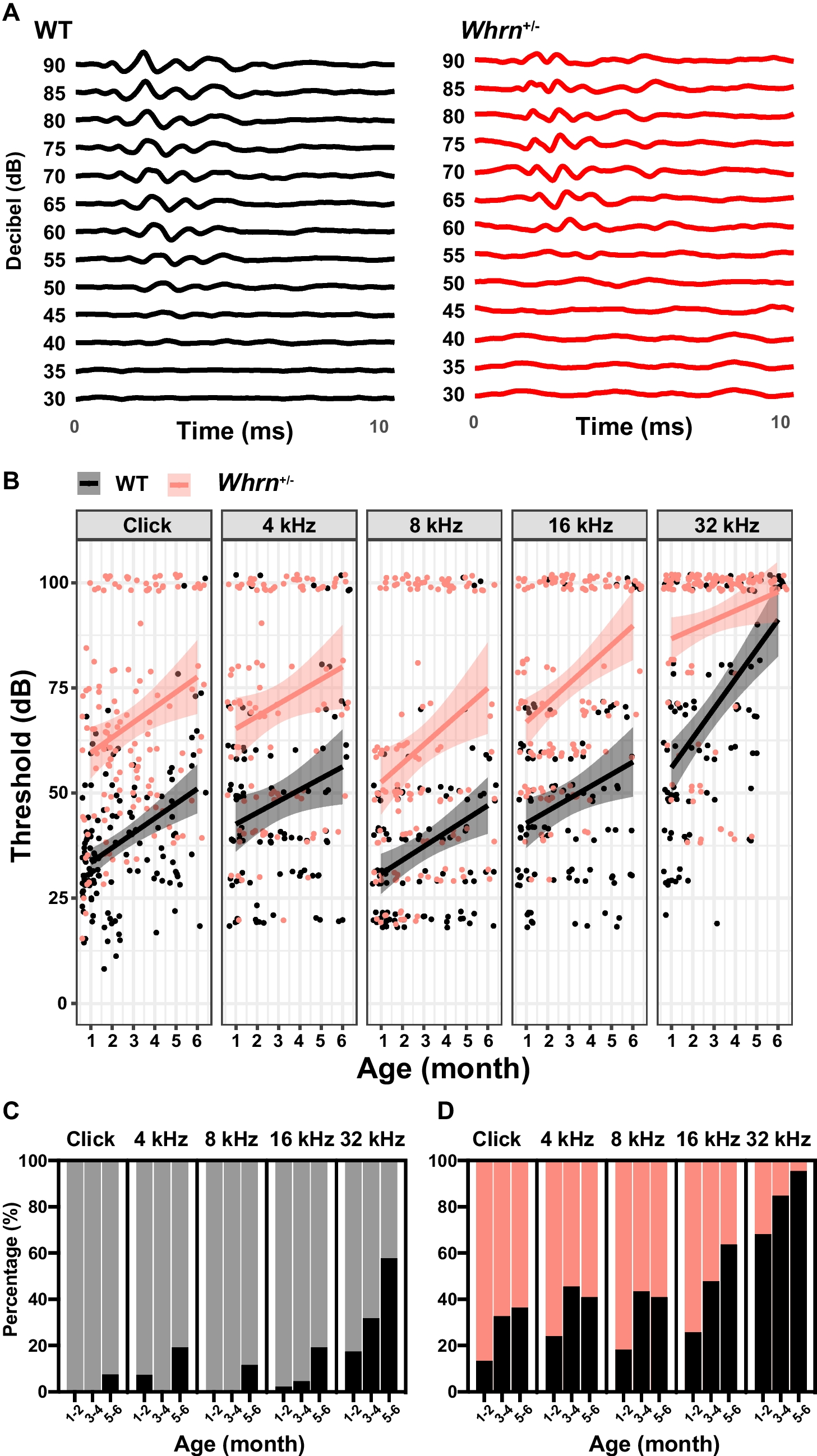 Haploinsufficiency of  Contributes to Progressive Sensorineural Hearing Loss in C57BL6 Mice