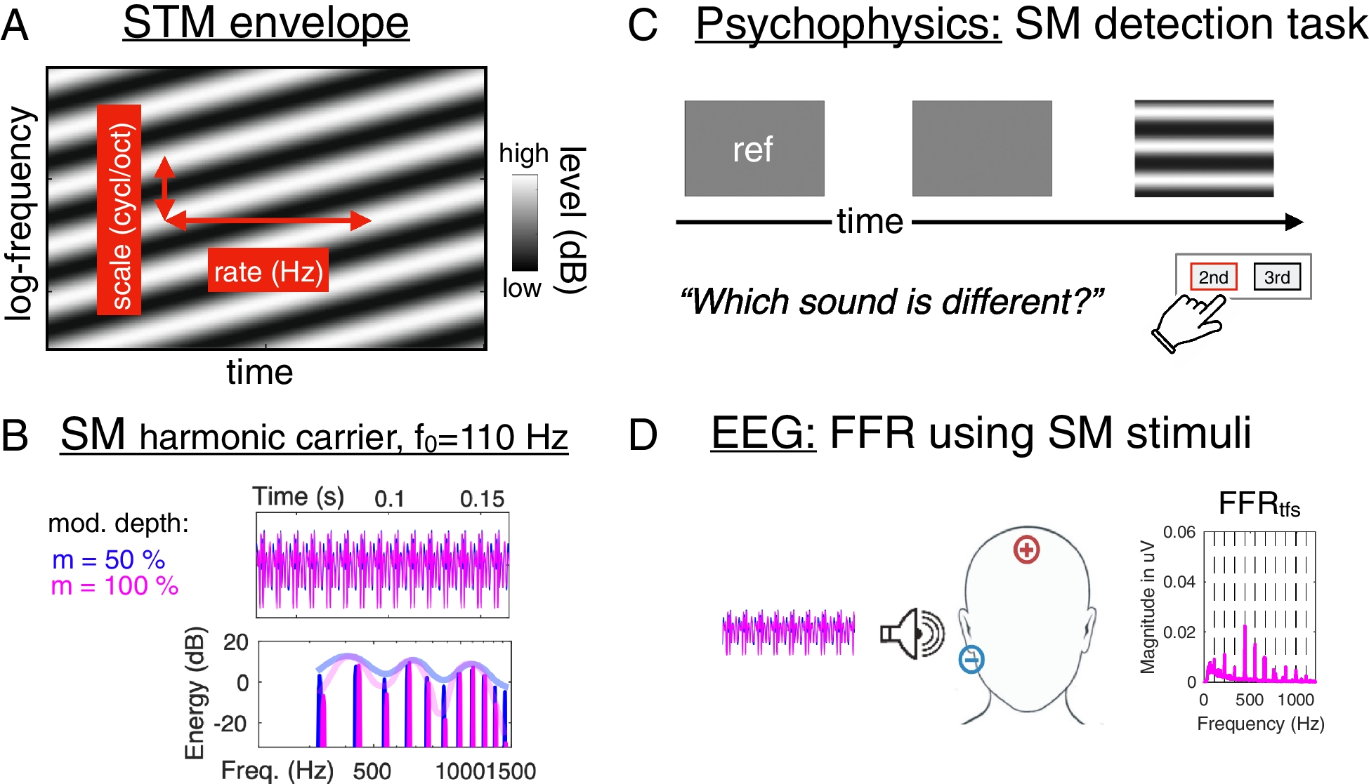 Age-Related Decline in Neural Phase-Locking to Envelope and Temporal Fine Structure Revealed by Frequency Following Responses: A Potential Signature of Cochlear Synaptopathy Impairing Speech Intelligibility