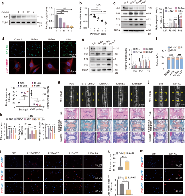 Chaperone-mediated autophagy directs a dual mechanism to balance premature senescence and senolysis to prevent intervertebral disc degeneration