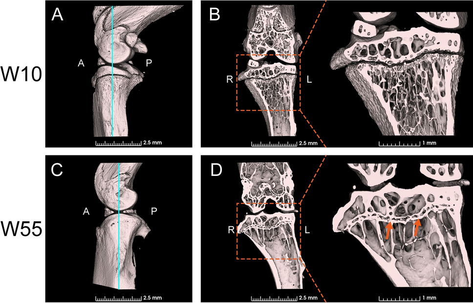 Mineral Content and Extracellular Matrix Protein Expression in Mouse Growth Plates During Epiphyseal Fusion: An Observational Study