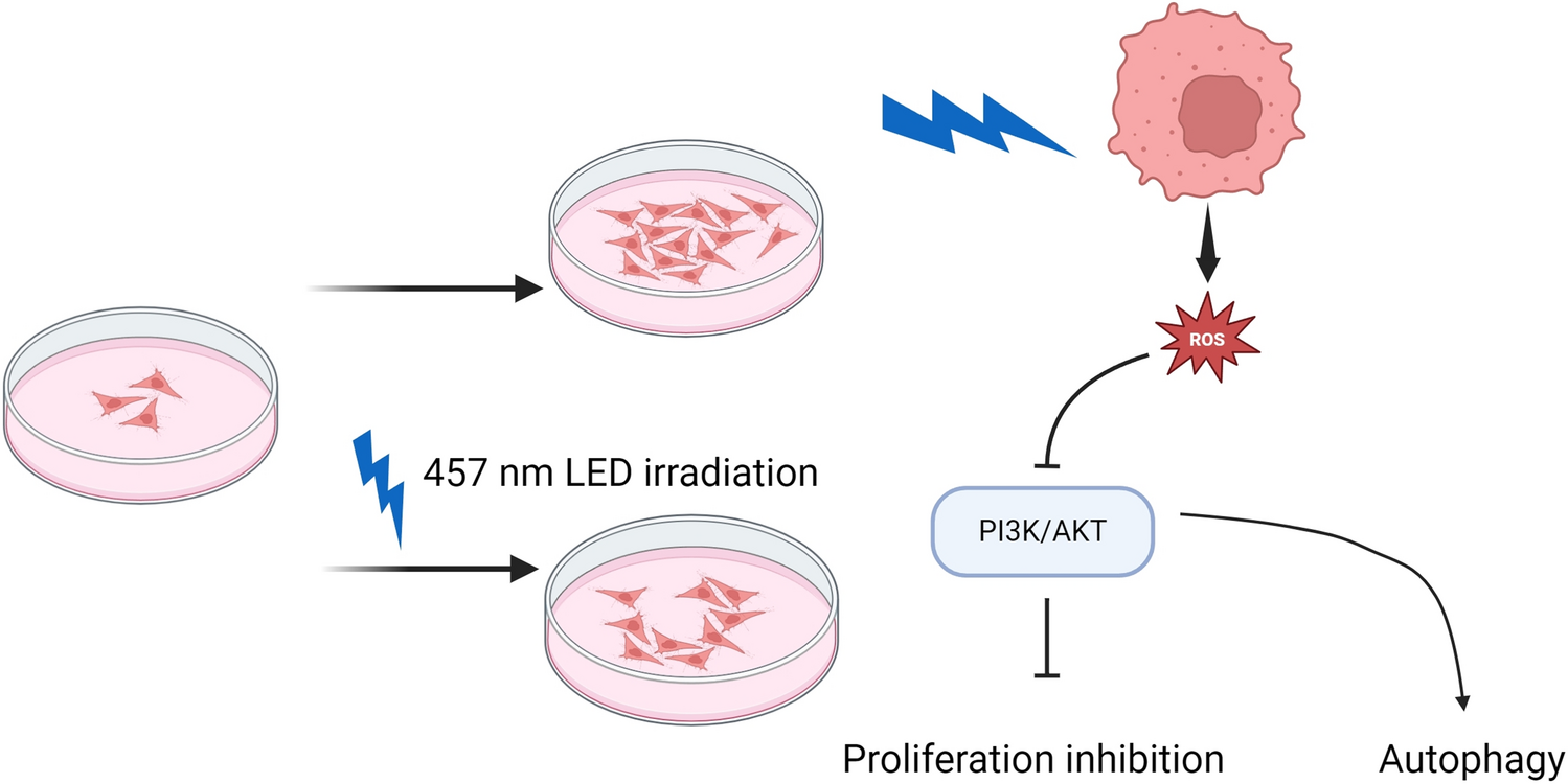 457 nm LED blue light inhibits oral squamous cell carcinoma cell proliferation via the PI3K/AKT pathway and autophagy