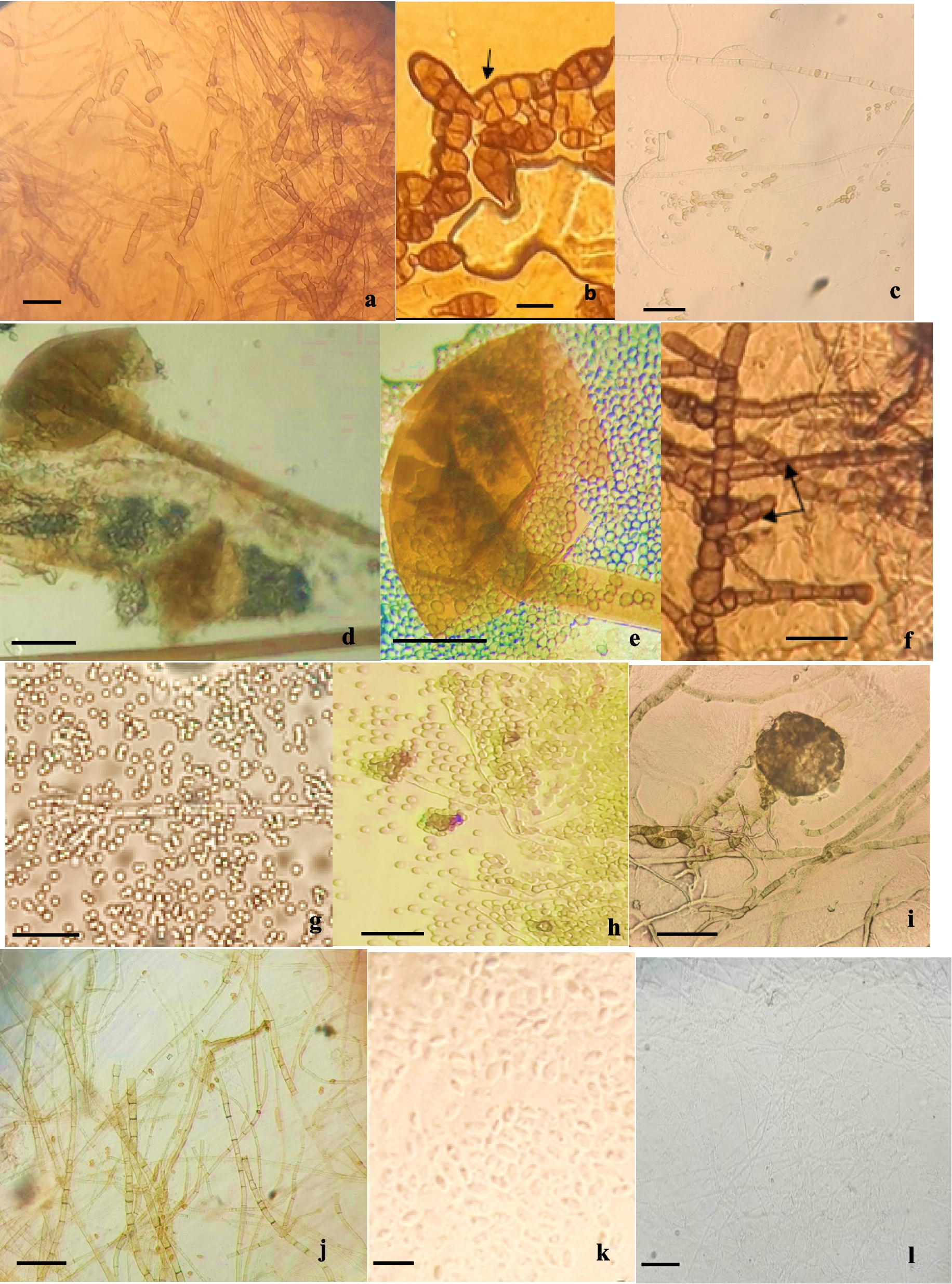Endophytic fungal communities of —an important medicinal plant of Tizi-Ouzou (Algeria)