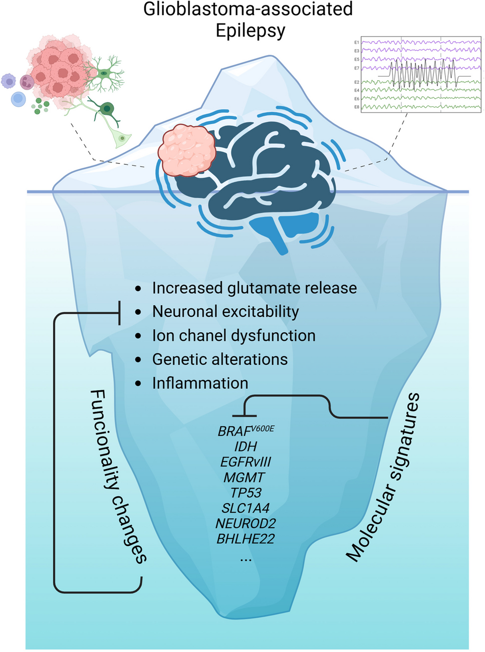 The molecular landscape of glioblastoma-associated epilepsy