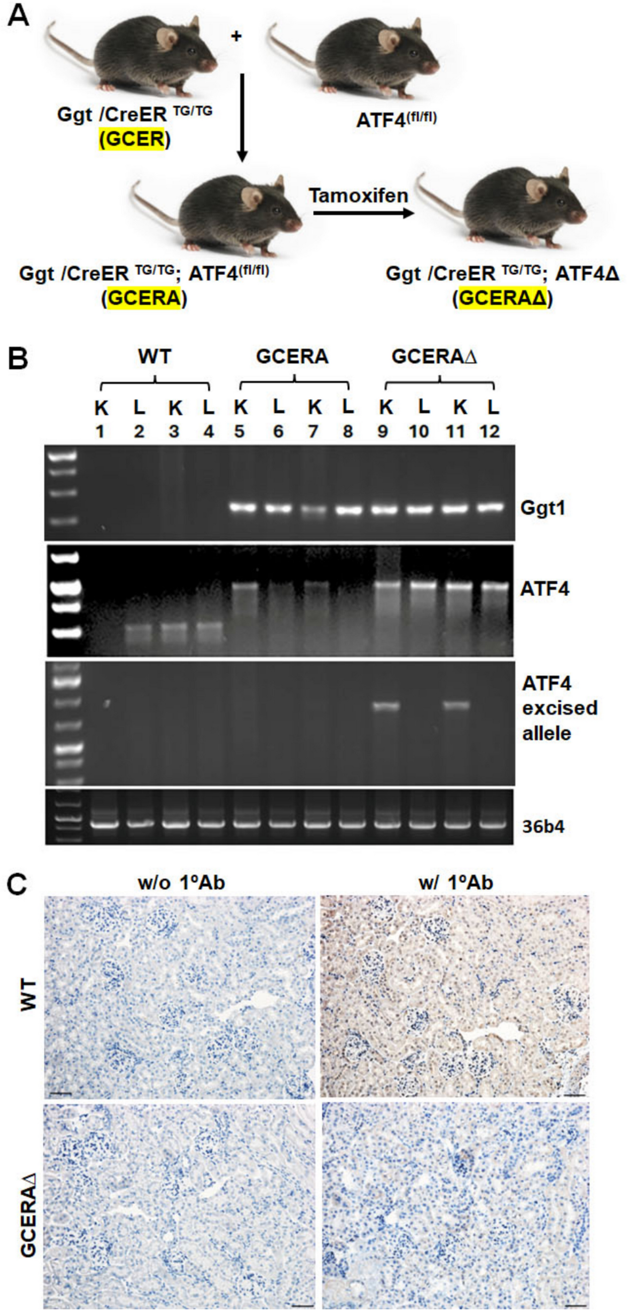 ATF4 in proximal tubules modulates kidney function and modifies the metabolome
