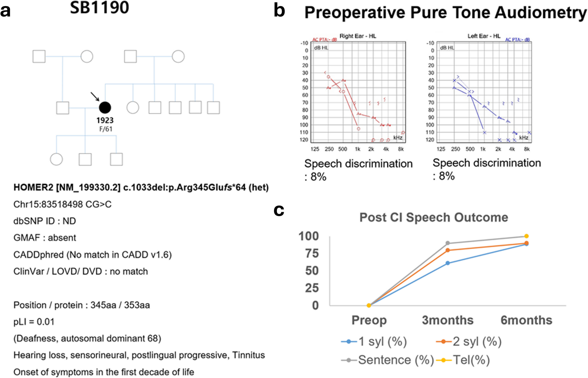 Impact of  frameshift extension variant on auditory function and development