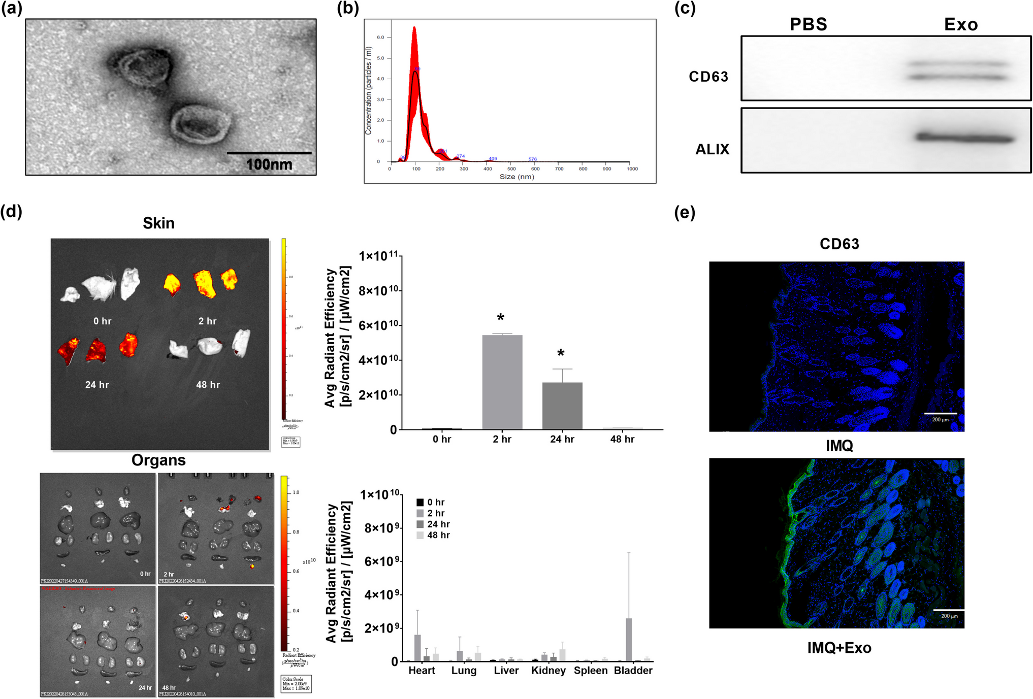 MicroRNA-100-5p in exosomes from human placental mesenchymal stem cells: a key modulator of anti-psoriatic effects through mTOR/S6 K1 pathway