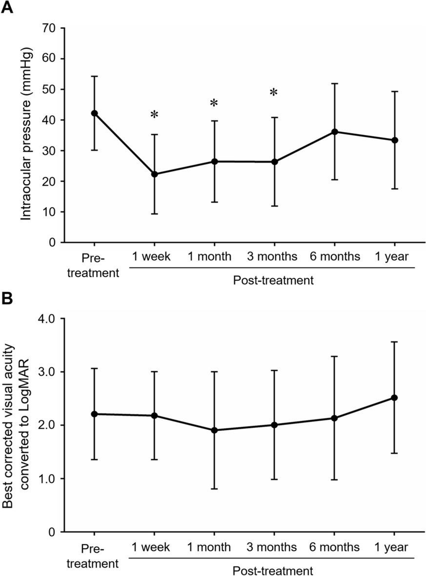 Cyclocryotherapy applied at the 3 o’clock and 9 o’clock positions combined with anti-VEGF injections for advanced neovascular glaucoma
