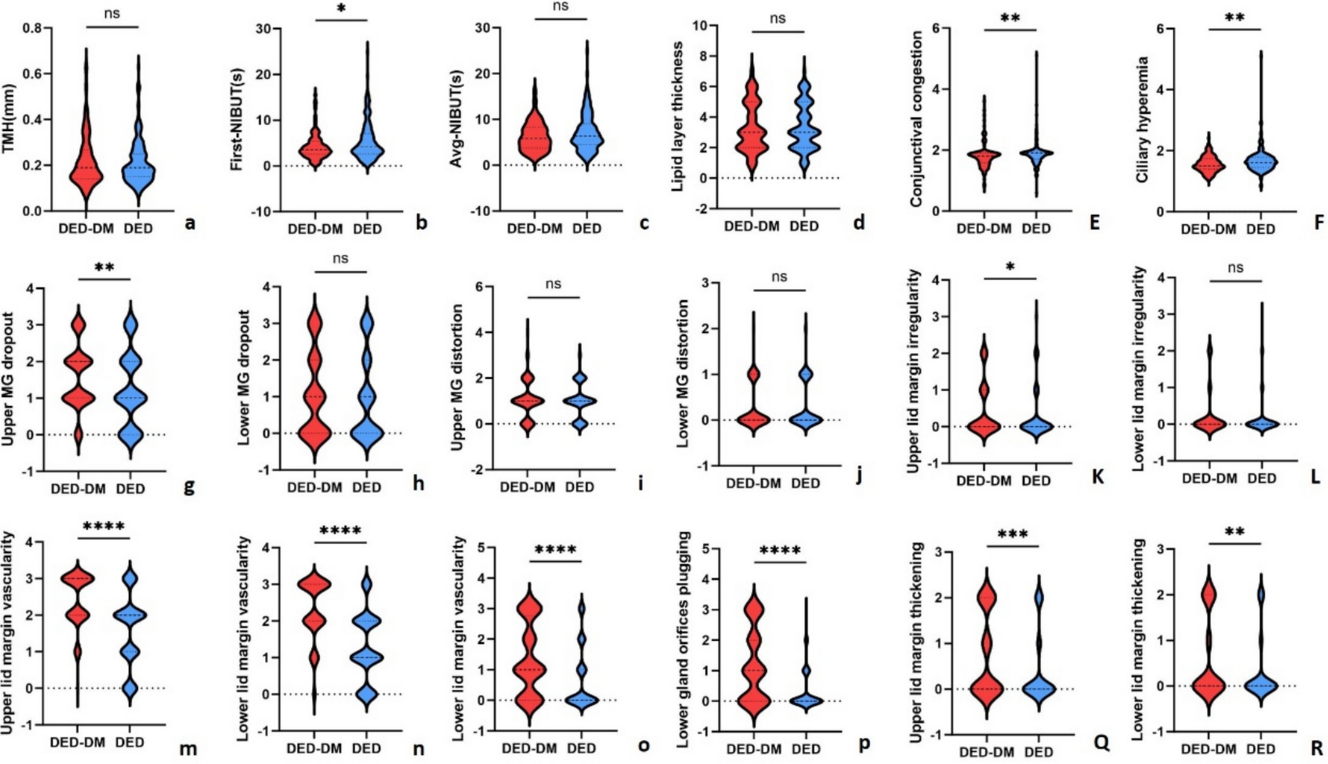 Relationship between type 2 diabetes mellitus and changes of the lid margin, meibomian gland and tear film in dry eye patients: a cross-sectional study