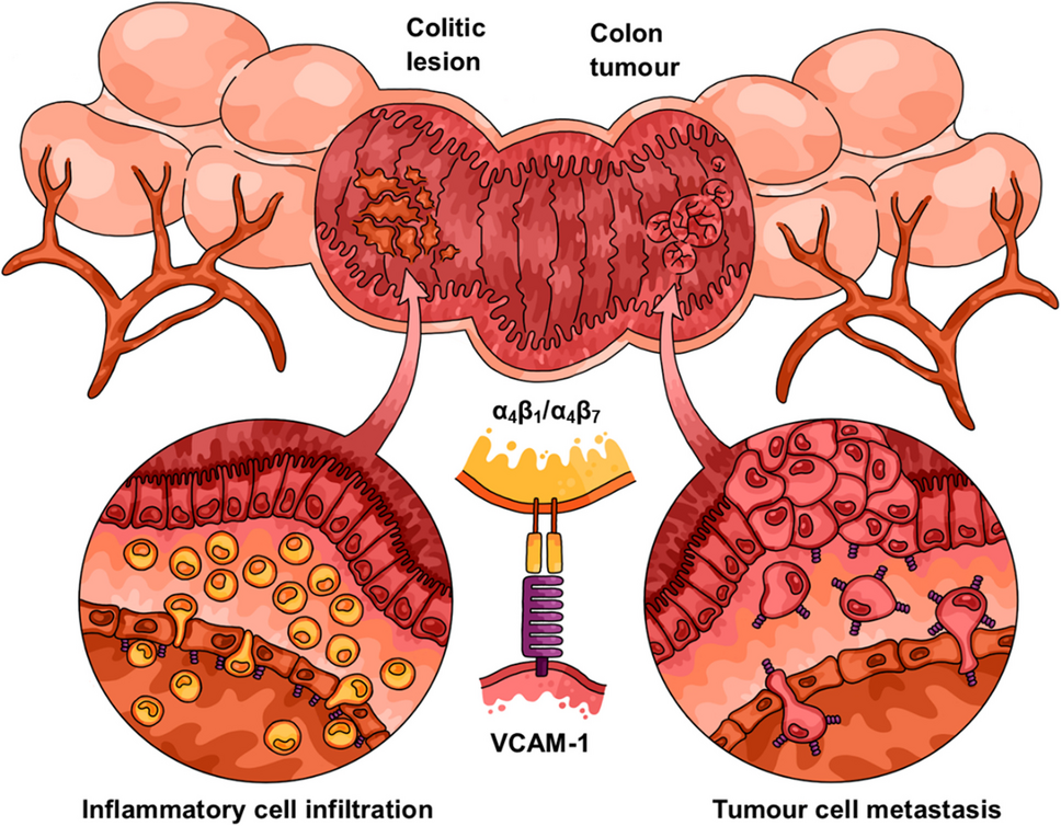 VCAM-1 as a common biomarker in inflammatory bowel disease and colorectal cancer: unveiling the dual anti-inflammatory and anti-cancer capacities of anti-VCAM-1 therapies