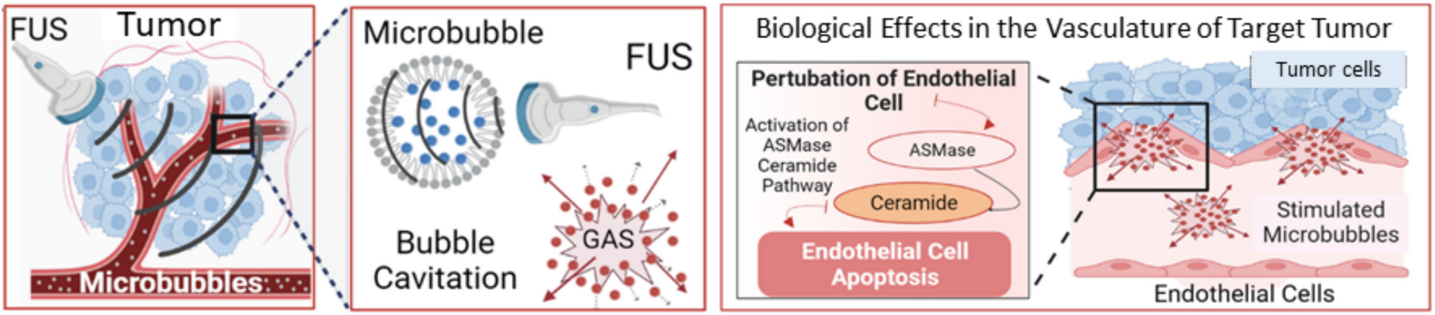 Using ultrasound and microbubble to enhance the effects of conventional cancer therapies in clinical settings