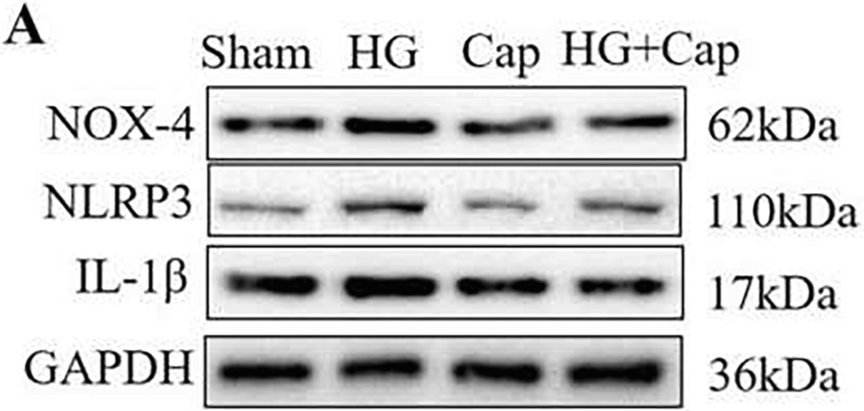 Correction to: Non-Invasive Local Acoustic Therapy Ameliorates Diabetic Heart Fibrosis by Suppressing ACE-Mediated Oxidative Stress and Inflammation in Cardiac Fibroblasts