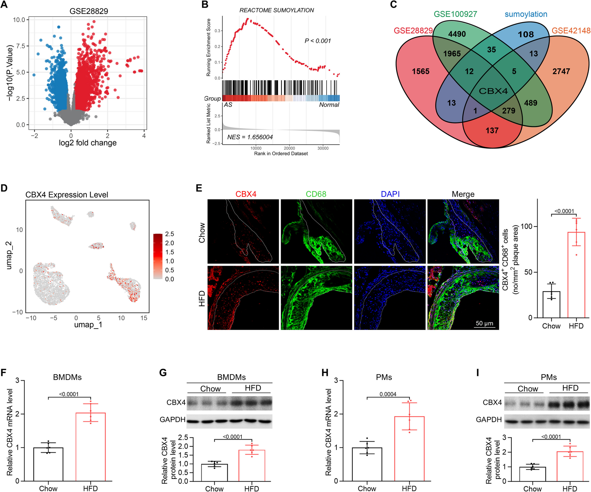 Macrophage CBX4 Potentiates Atherosclerosis by its SUMO E3 Ligase Activity