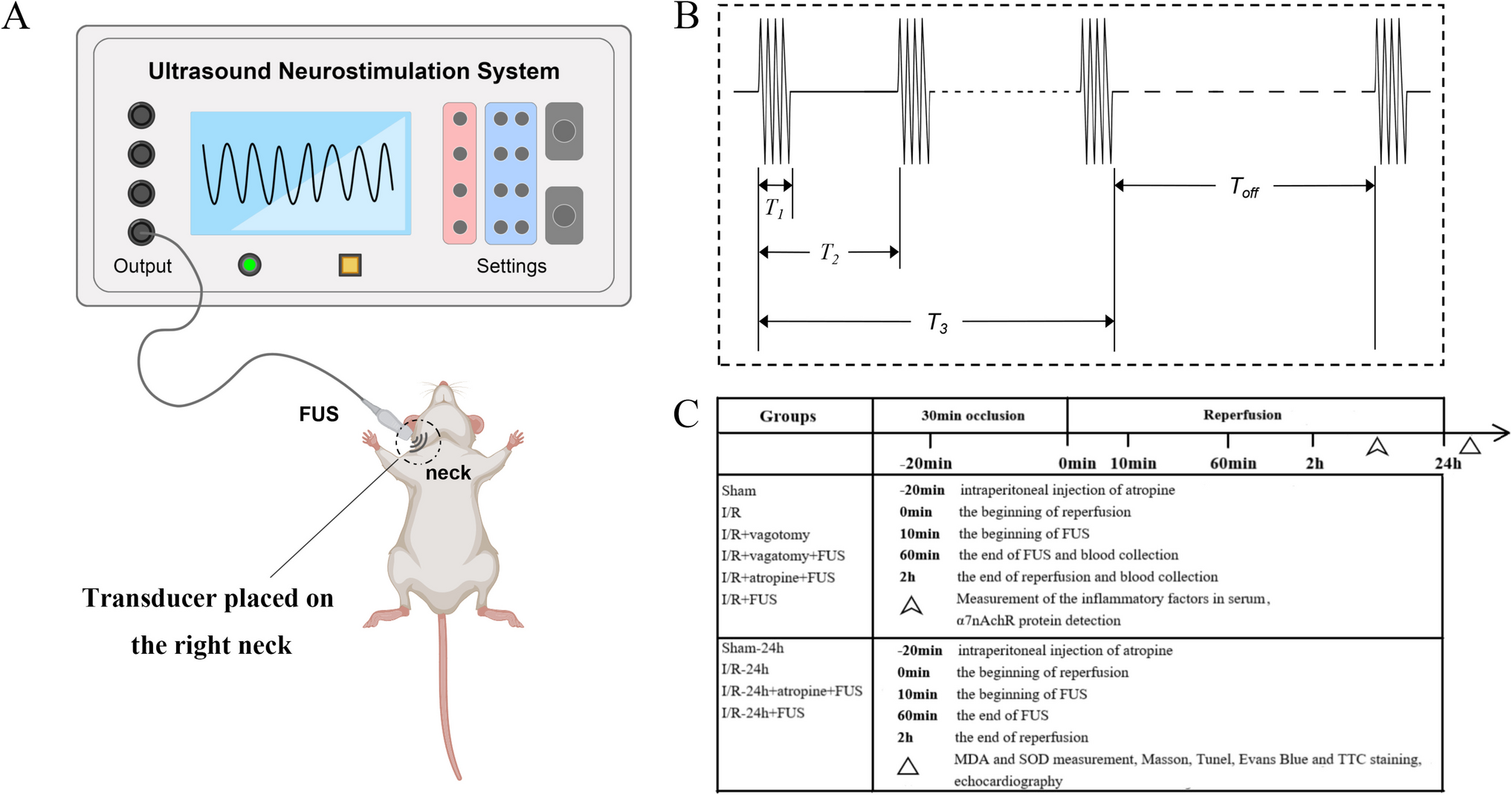 Vagus Nerve Stimulation by Focused Ultrasound Attenuates Acute Myocardial Ischemia/Reperfusion Injury Predominantly Through Cholinergic Anti-inflammatory Pathway