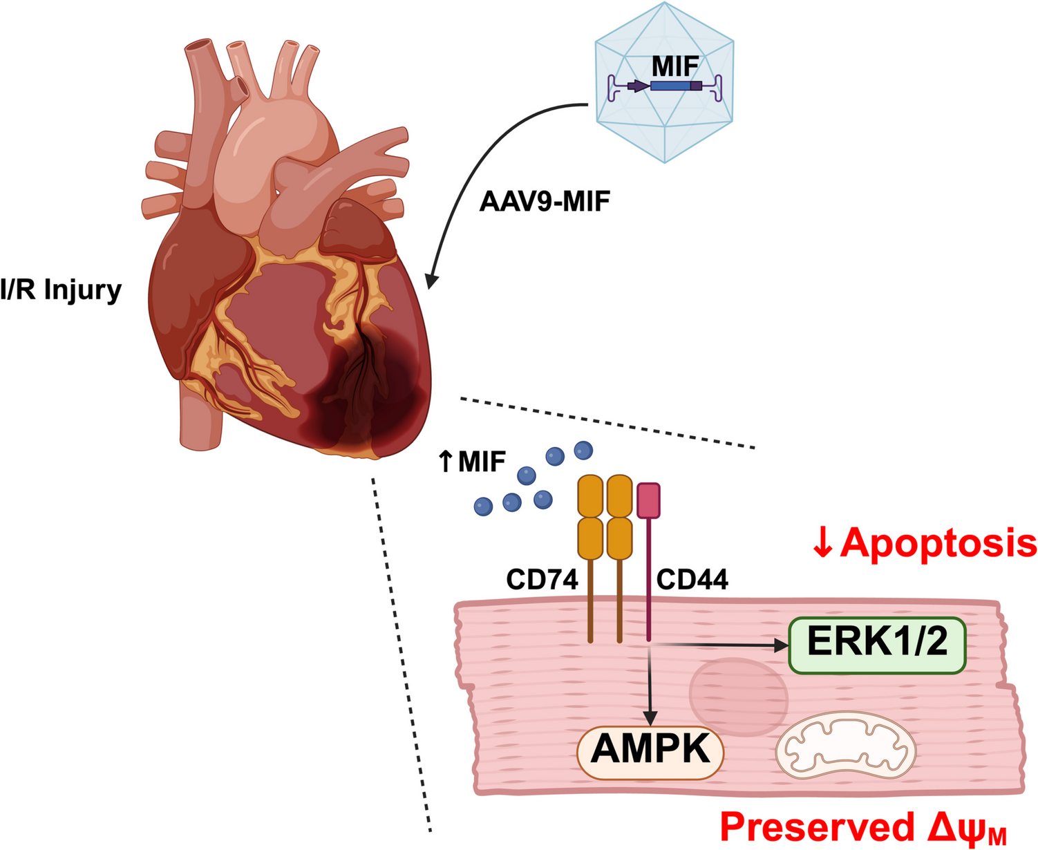 Macrophage Migration Inhibitory Factor: the Next Adjunct to Reperfusion Therapy in Acute Myocardial Infarction?