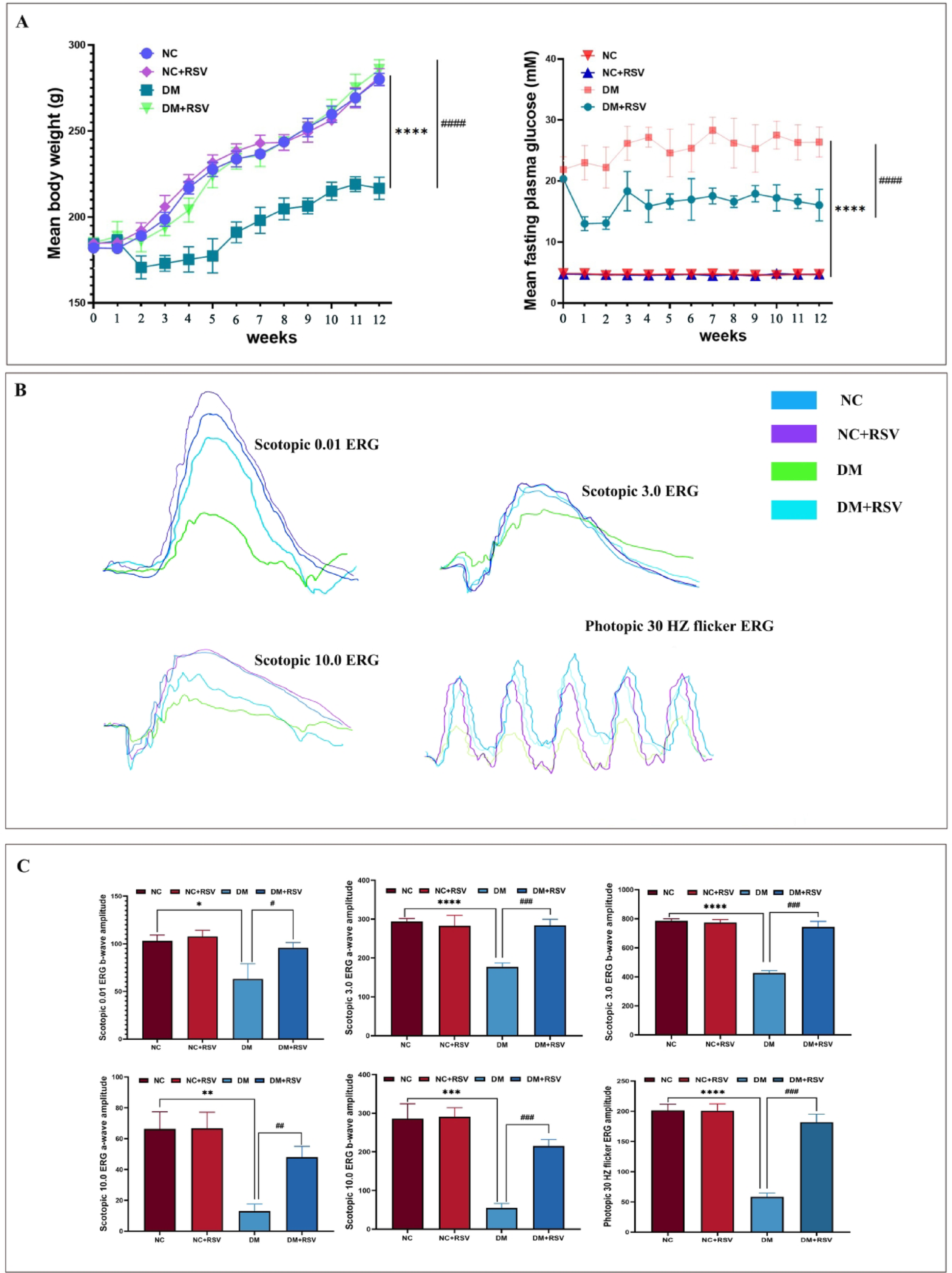 Resveratrol ameliorates early retinal neurodegeneration in diabetic retinopathy via microRNA-29b/specificity protein 1/apoptosis pathway by enhancing autophagy