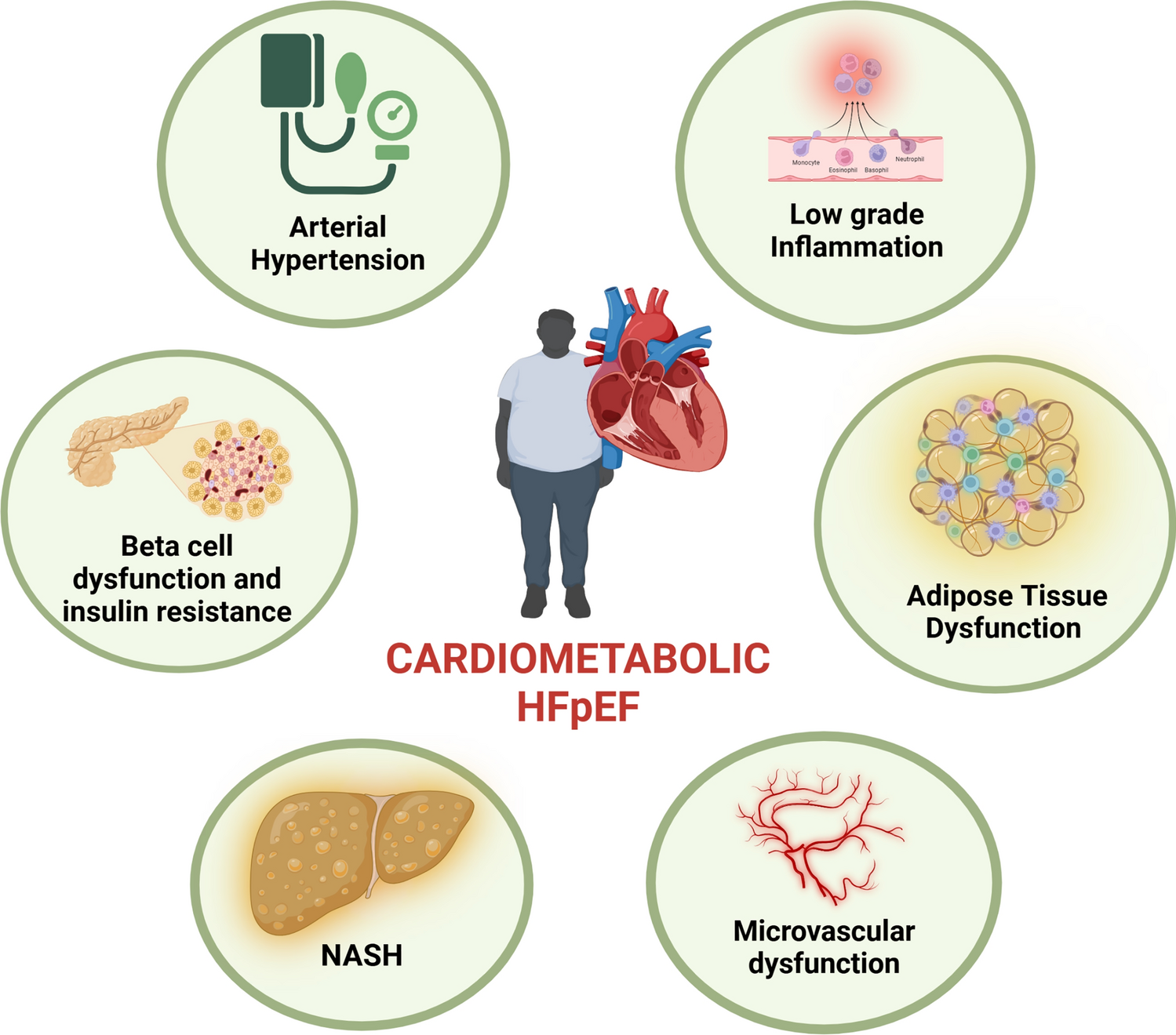 Cardiometabolic heart failure with preserved ejection fraction: from molecular signatures to personalized treatment