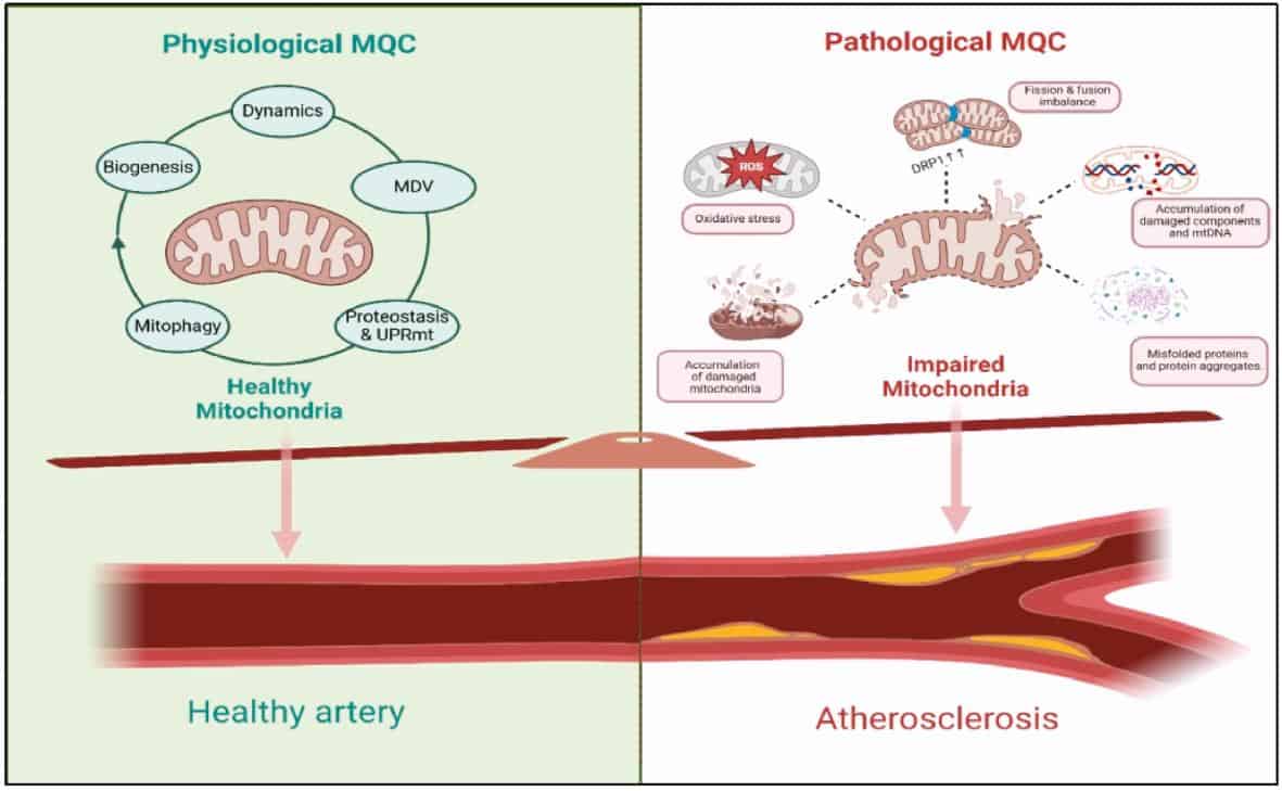 Roles of Mitochondrial Quality Control in the Pathogenesis of Atherosclerosis