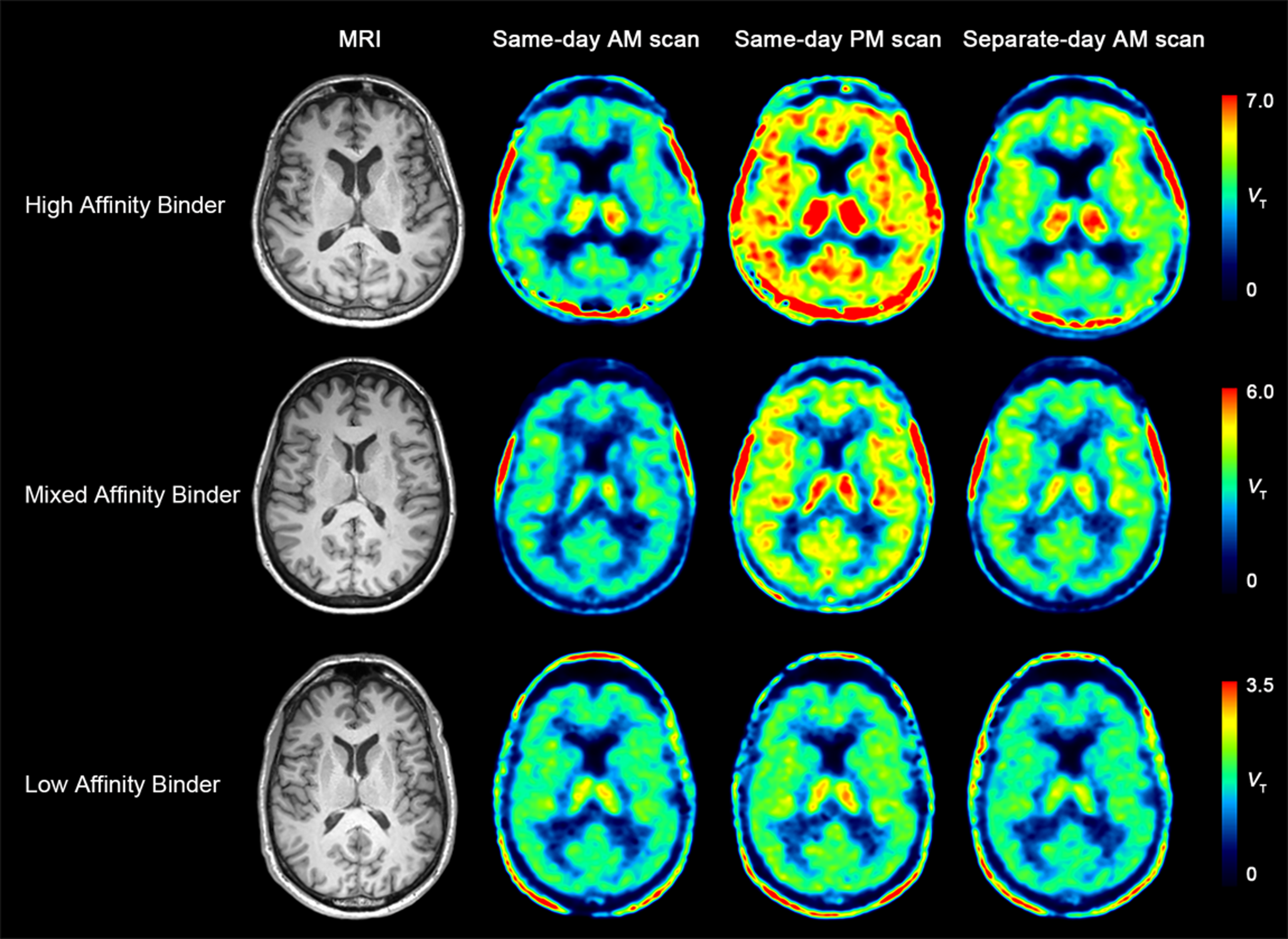 TSPO circadian pattern: a test-retest study of [C]ER176
