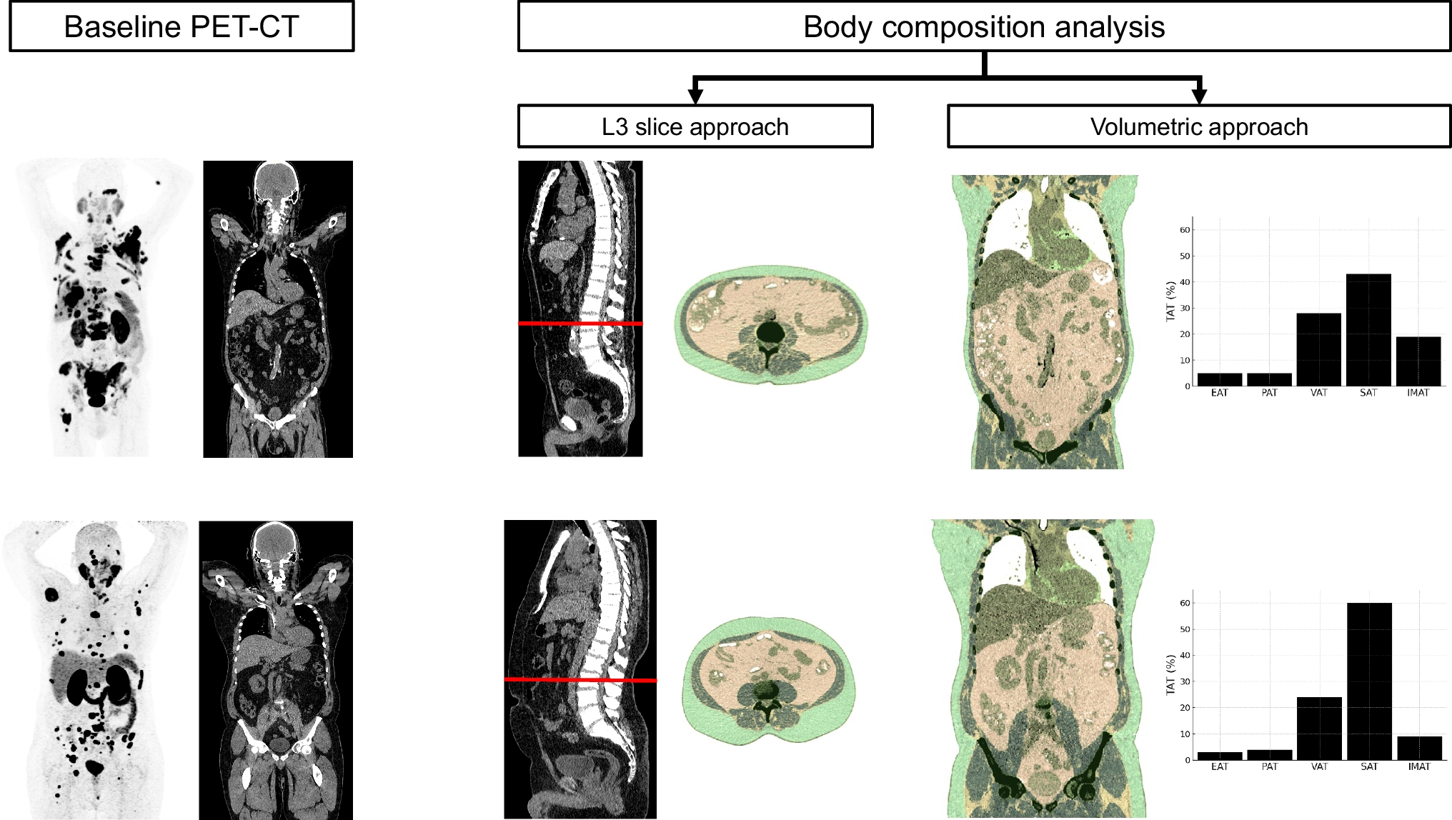 Prognostic value of body composition out of PSMA-PET/CT in prostate cancer patients undergoing PSMA-therapy