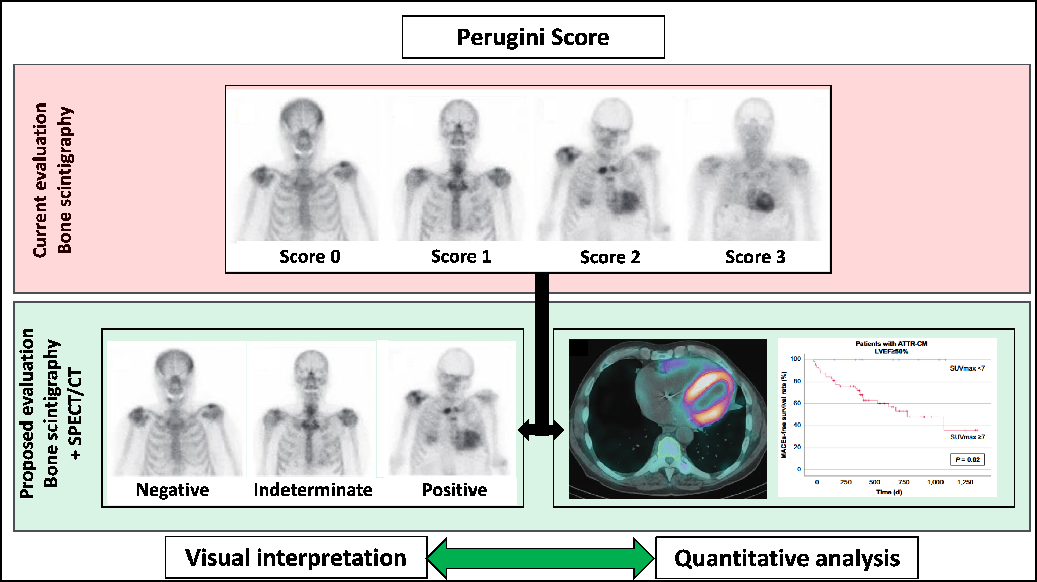 Visual grading for noninvasive assessment of transthyretin-related cardiomyopathy with bone scintigraphy: time for moving forward?
