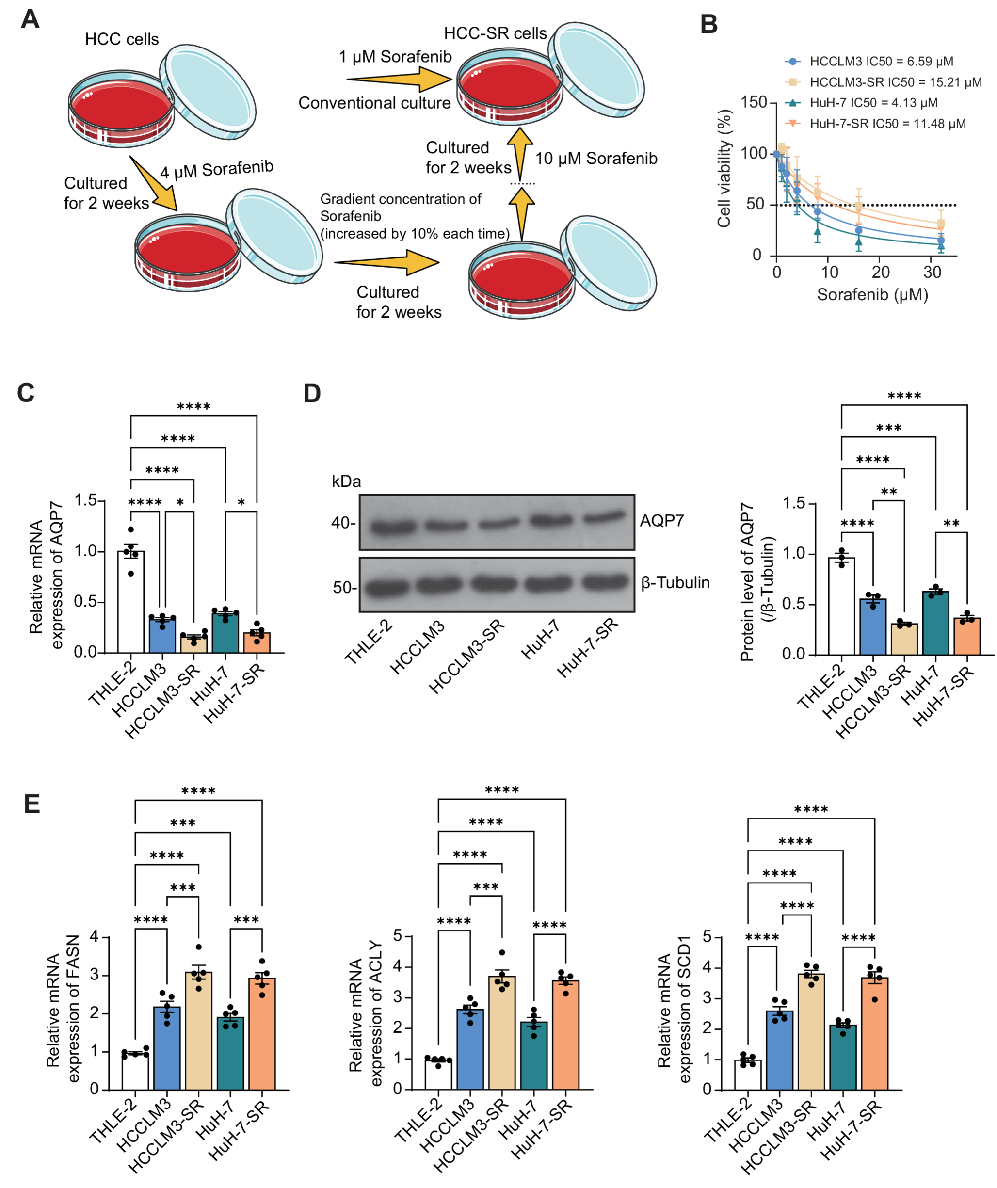 Aquaglyceroporin-7 ameliorates sorafenib resistance and immune evasion in hepatocellular carcinoma through inhibition of lipid accumulation