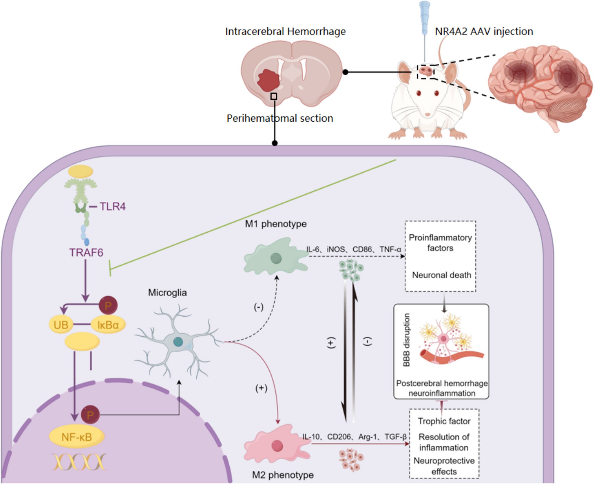 NR4A2 attenuates early brain injury after intracerebral hemorrhage by promoting M2 microglial polarization via TLR4/TRAF6/NF-κB pathway inhibition