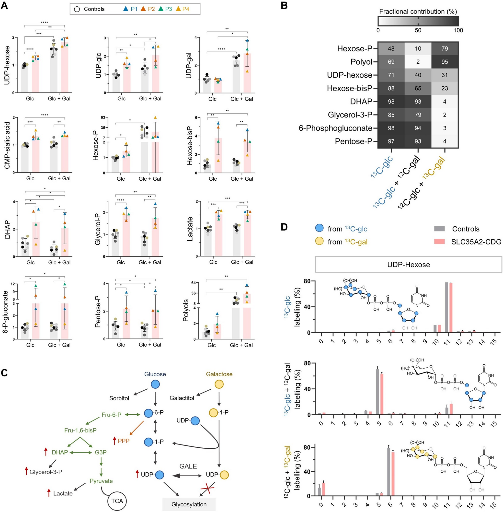 Glycosphingolipid synthesis is impaired in SLC35A2-CDG and improves with galactose supplementation