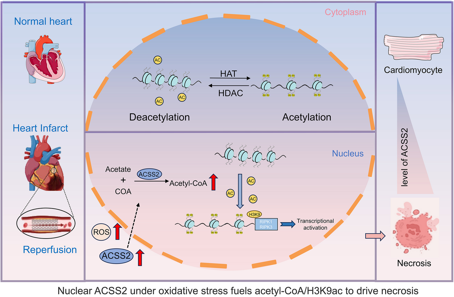 Acetyl-CoA Short-Chain Synthetase-2 Regulates Myocardial Ischemia/Reperfusion Injury by Targeting Histone Acetylation
