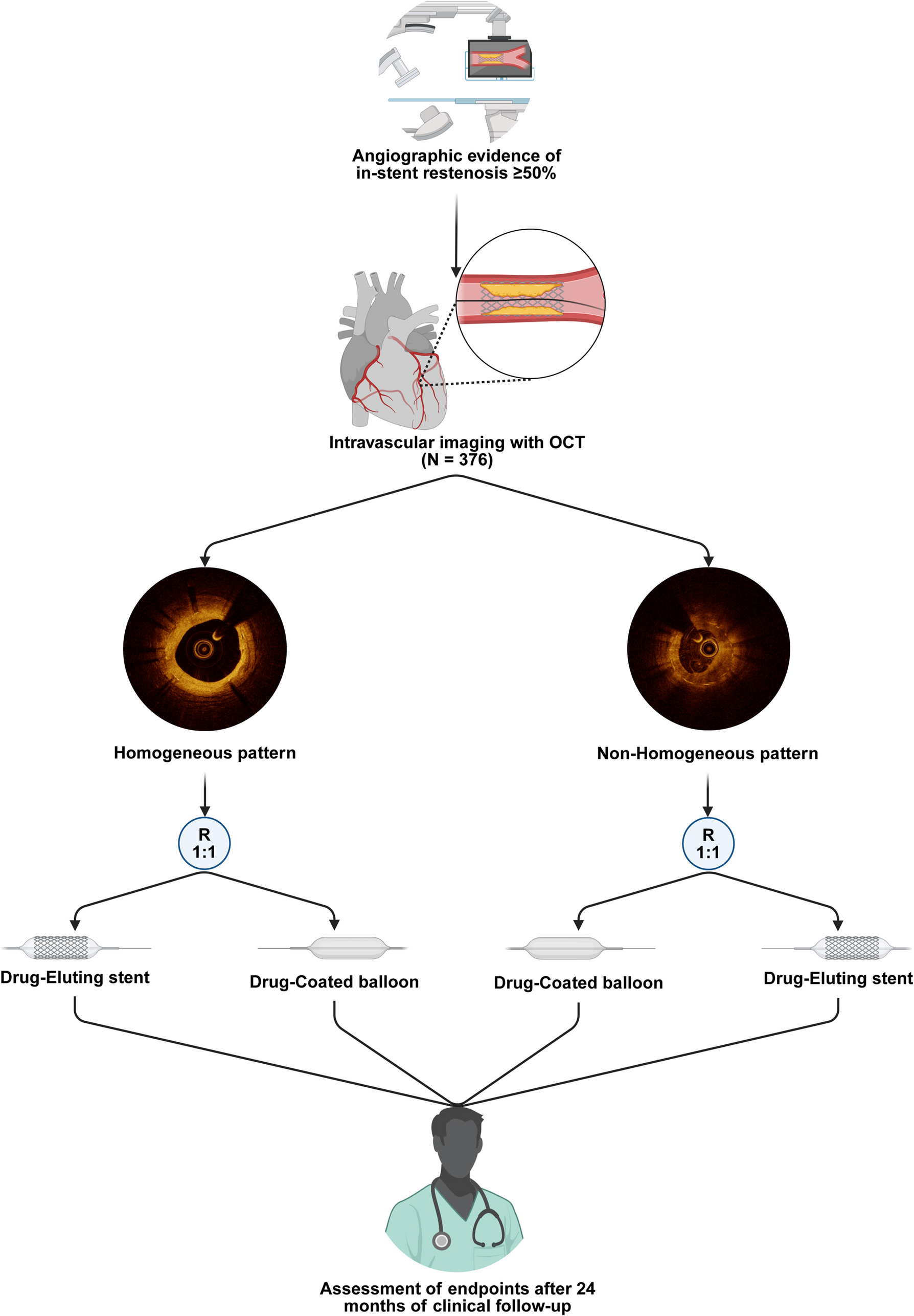 Intracoronary Stenting and Restenosis – Randomized Trial of Drug-Eluting Stent Implantation or Drug-Coated Balloon Angioplasty According to Neointima Morphology in Drug-Eluting Stent REstenosis 5: Rationale and Design of the ISAR-DESIRE 5 Trial