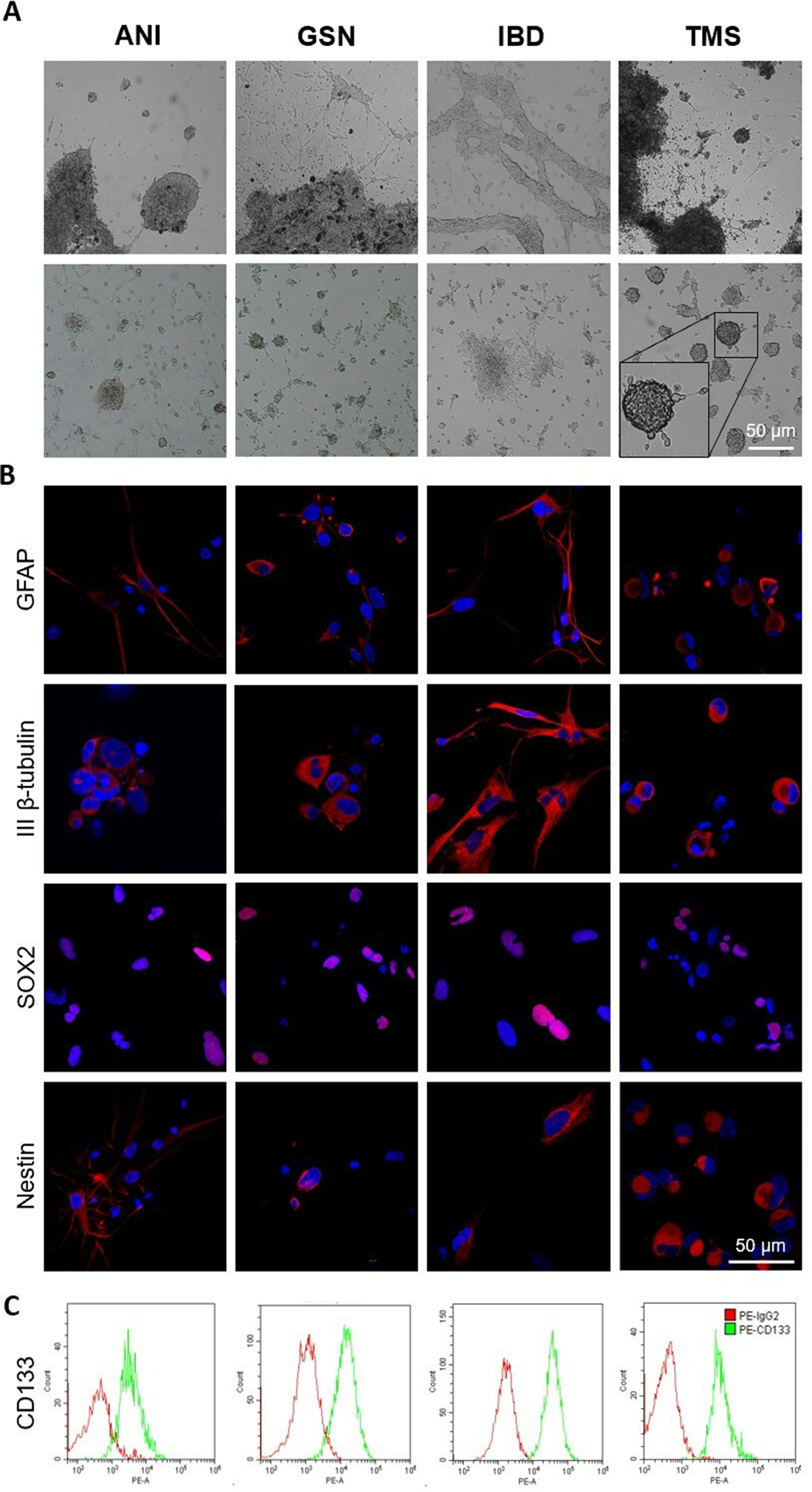 Glioblastoma cell motility and invasion is regulated by membrane-associated heat shock protein Hsp70