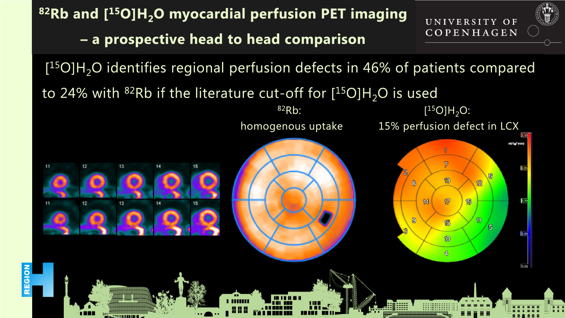 Rb and [O]HO myocardial perfusion PET imaging: a prospective head to head comparison