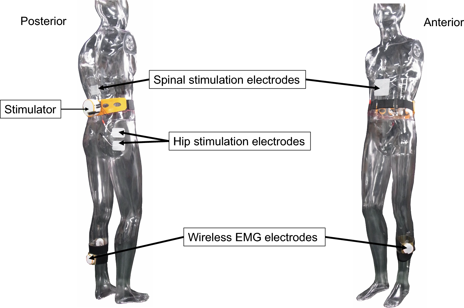 Electromyography (EMG)-triggered transcutaneous spinal cord and hip stimulation for gait rehabilitation in persons with chronic stroke: a randomized, controlled trial