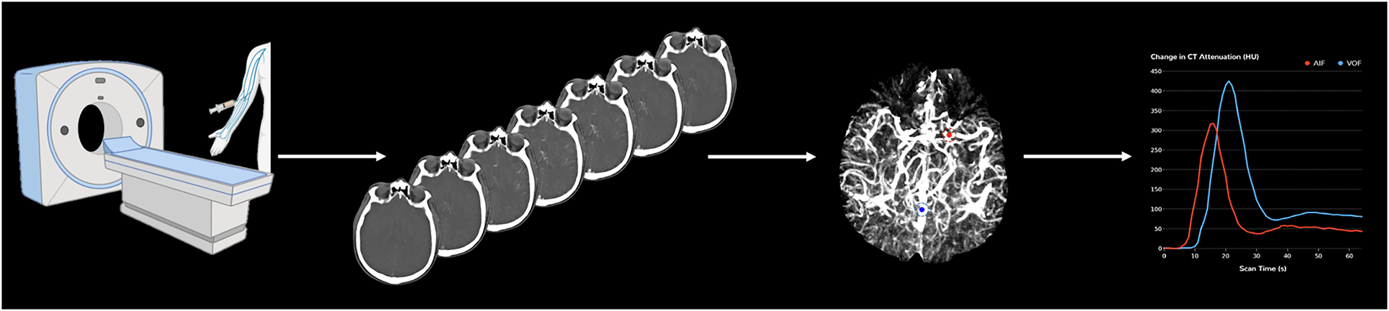 Evolution of CT perfusion software in stroke imaging: from deconvolution to artificial intelligence
