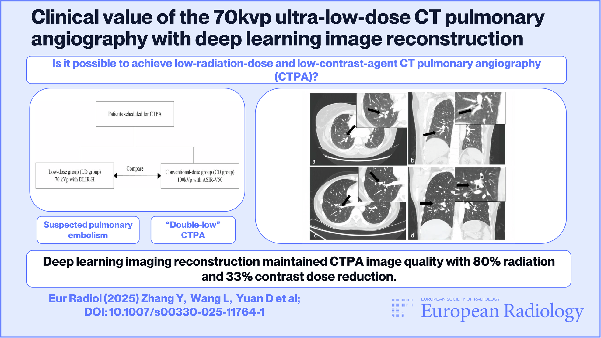 Clinical value of the 70-kVp ultra-low-dose CT pulmonary angiography with deep learning image reconstruction