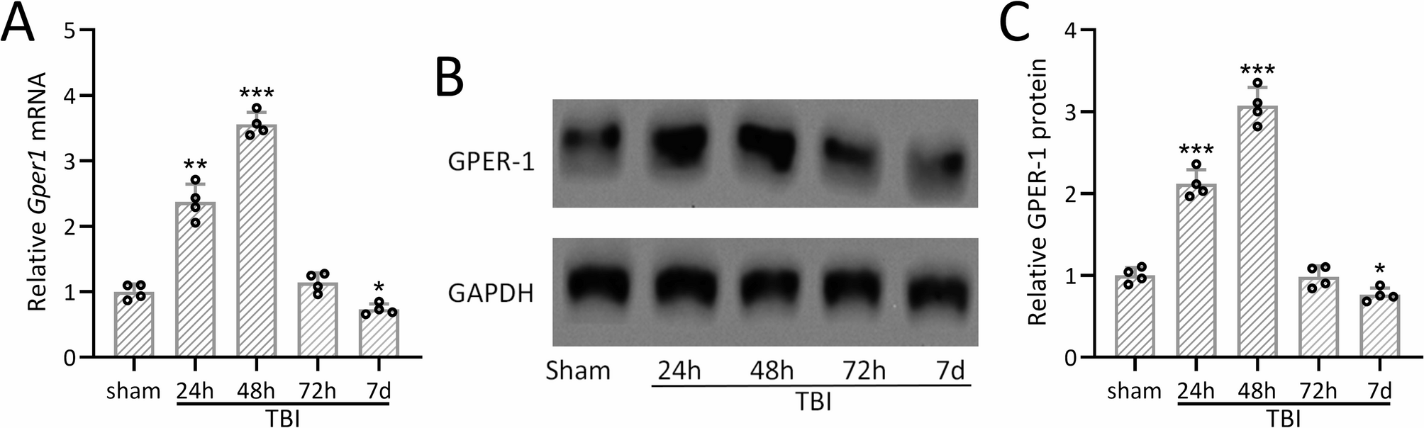 Gper1 inhibition exacerbates traumatic brain injury-induced neurological impairments in mice