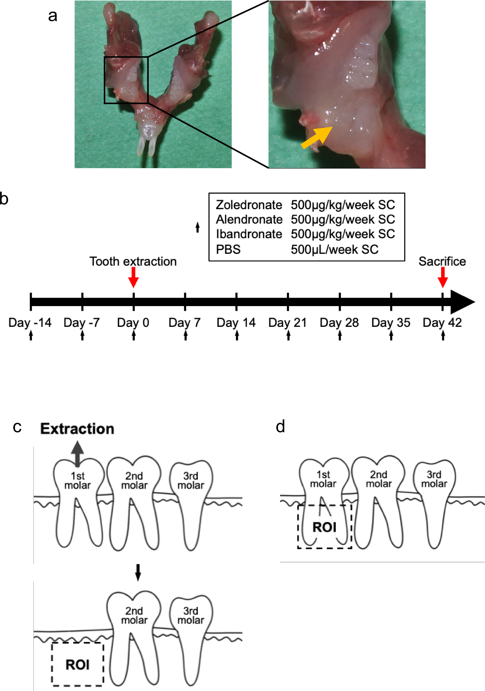 Bisphosphonates with high bone-resorption-capacity promote osteonecrosis of the jaw development after tooth extraction in mice