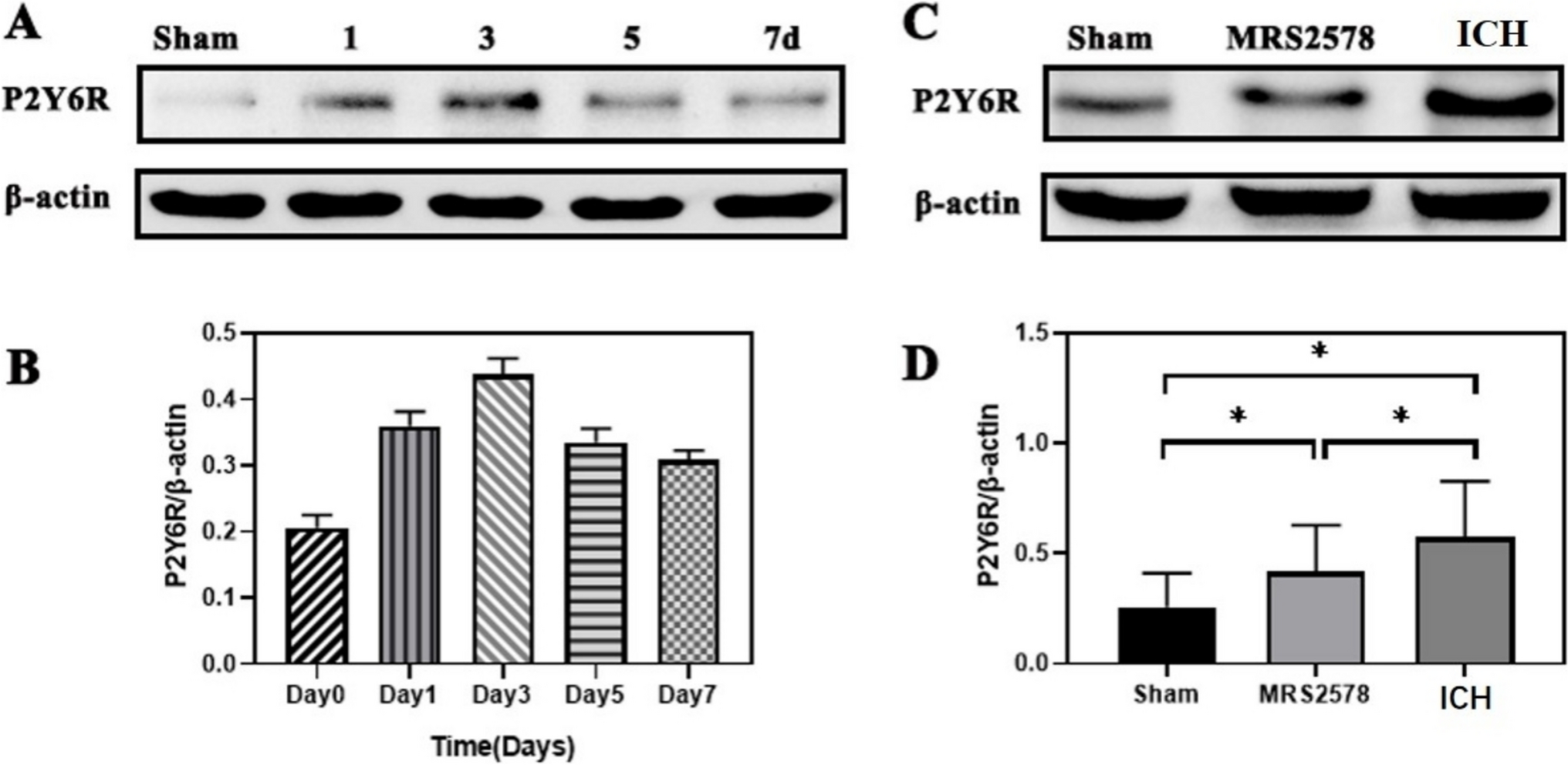 Inhibition of P2Y6 Receptor-Mediated Microglia Phagocytosis Aggravates Brain Injury in Mice of Intracerebral Hemorrhage