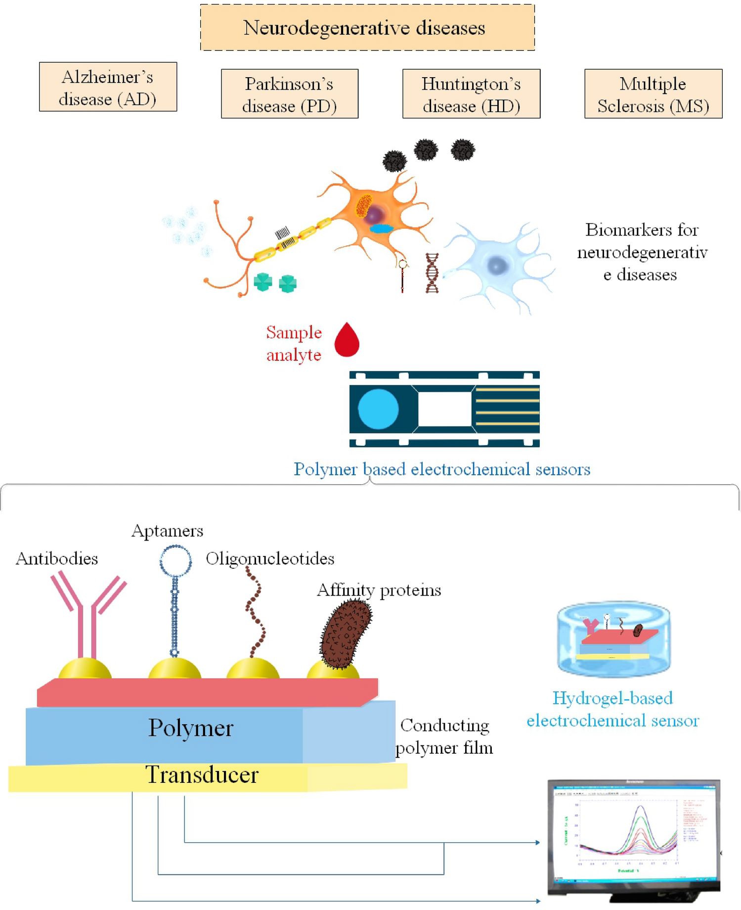 Polymer-Based Electrochemical Sensors for the Diagnosis of Neurodegenerative Diseases