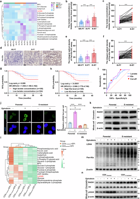 Irinotecan alleviates chemoresistance to anthracyclines through the inhibition of AARS1-mediated BLM lactylation and homologous recombination repair